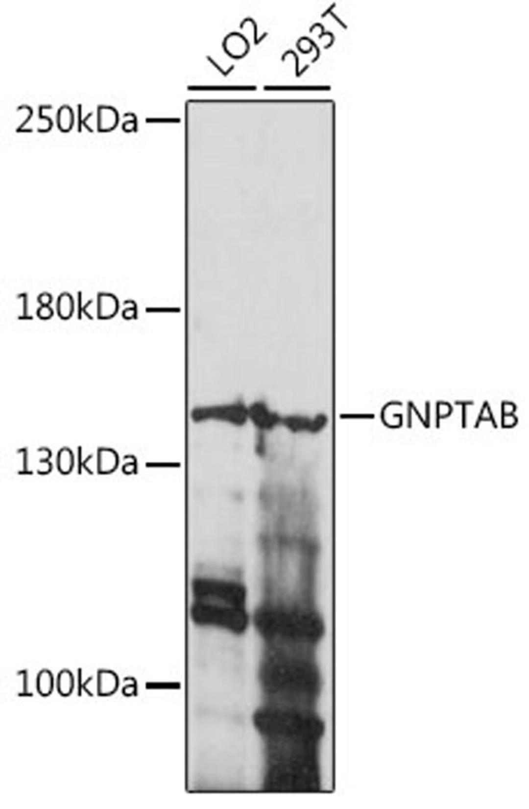 Western blot - GNPTAB antibody (A15895)