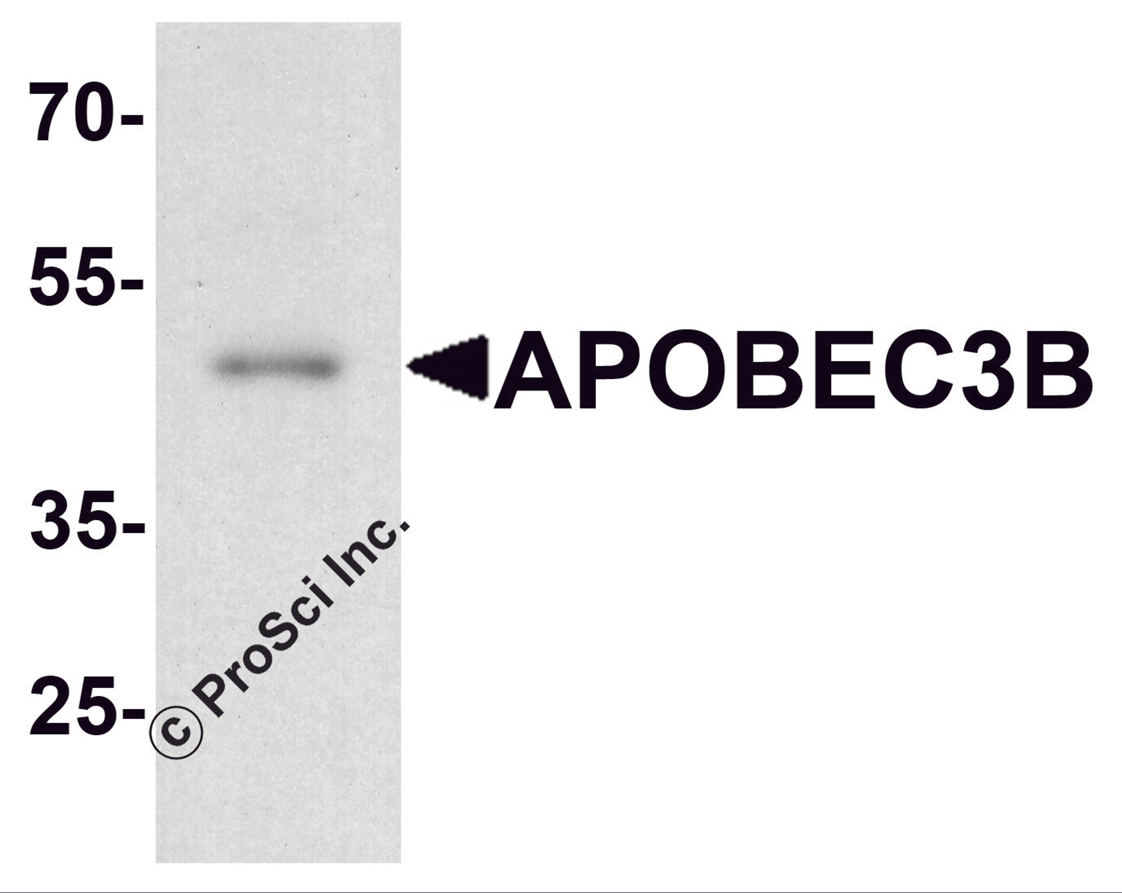 Western blot analysis of APOBEC3B in rat small intestine tissue lysate with APOBEC3B antibody at 1 μg/ml.