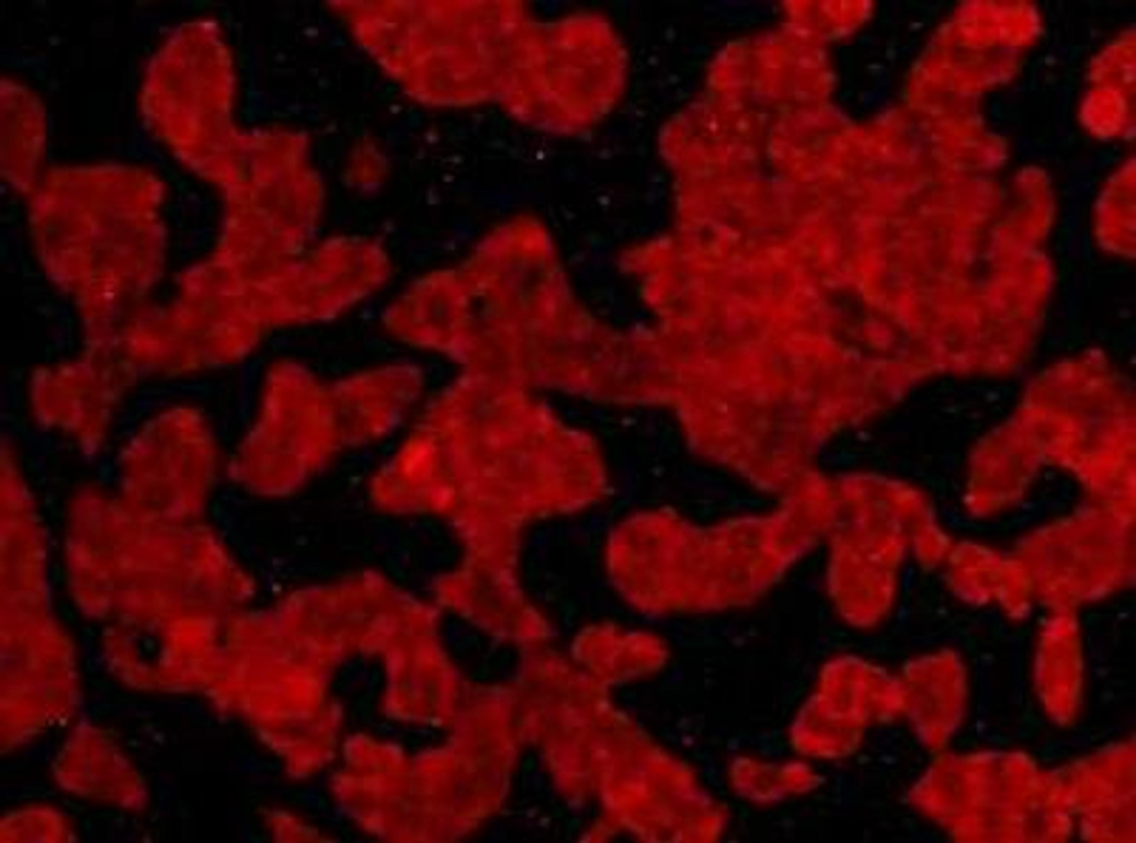 Immunofluorescent staining of Hela (red) Cells using C19orf35 antibody