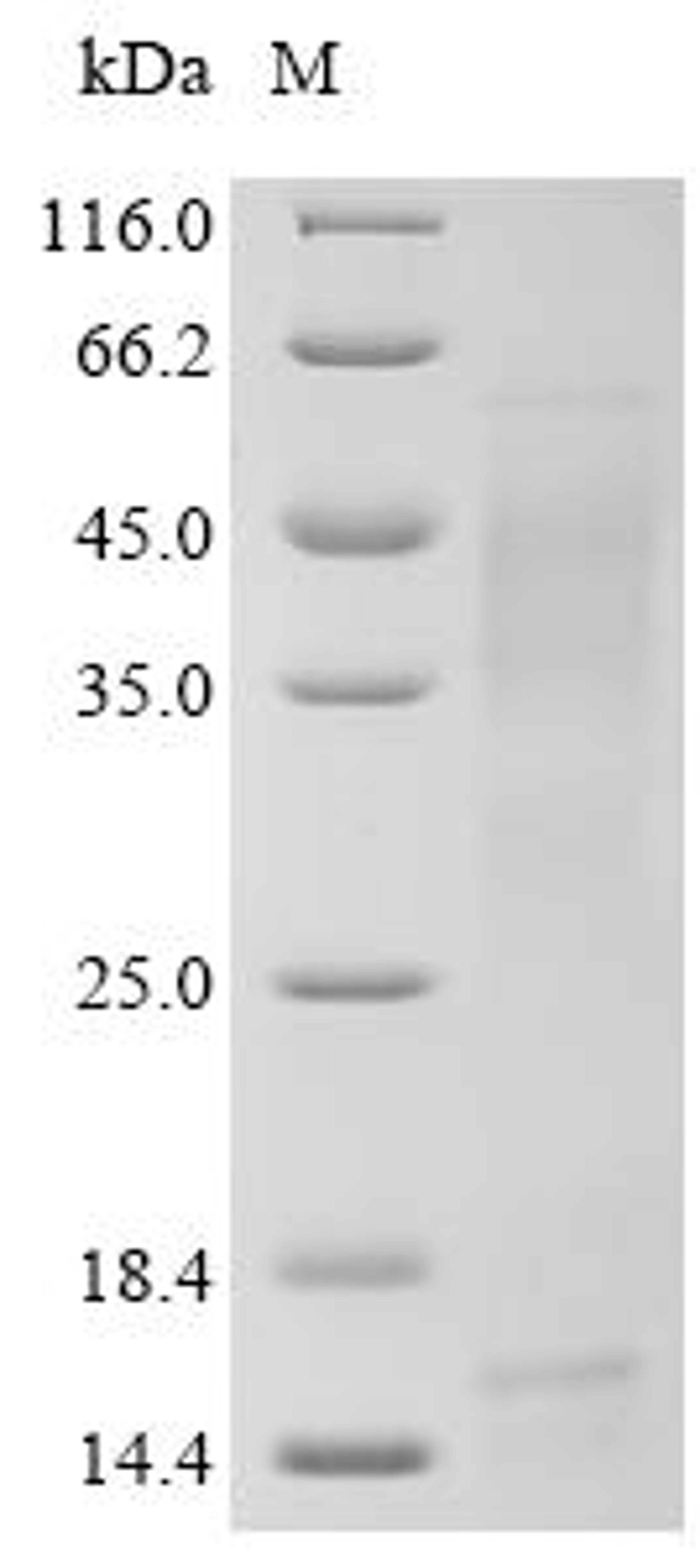 (Tris-Glycine gel) Discontinuous SDS-PAGE (reduced) with 5% enrichment gel and 15% separation gel.