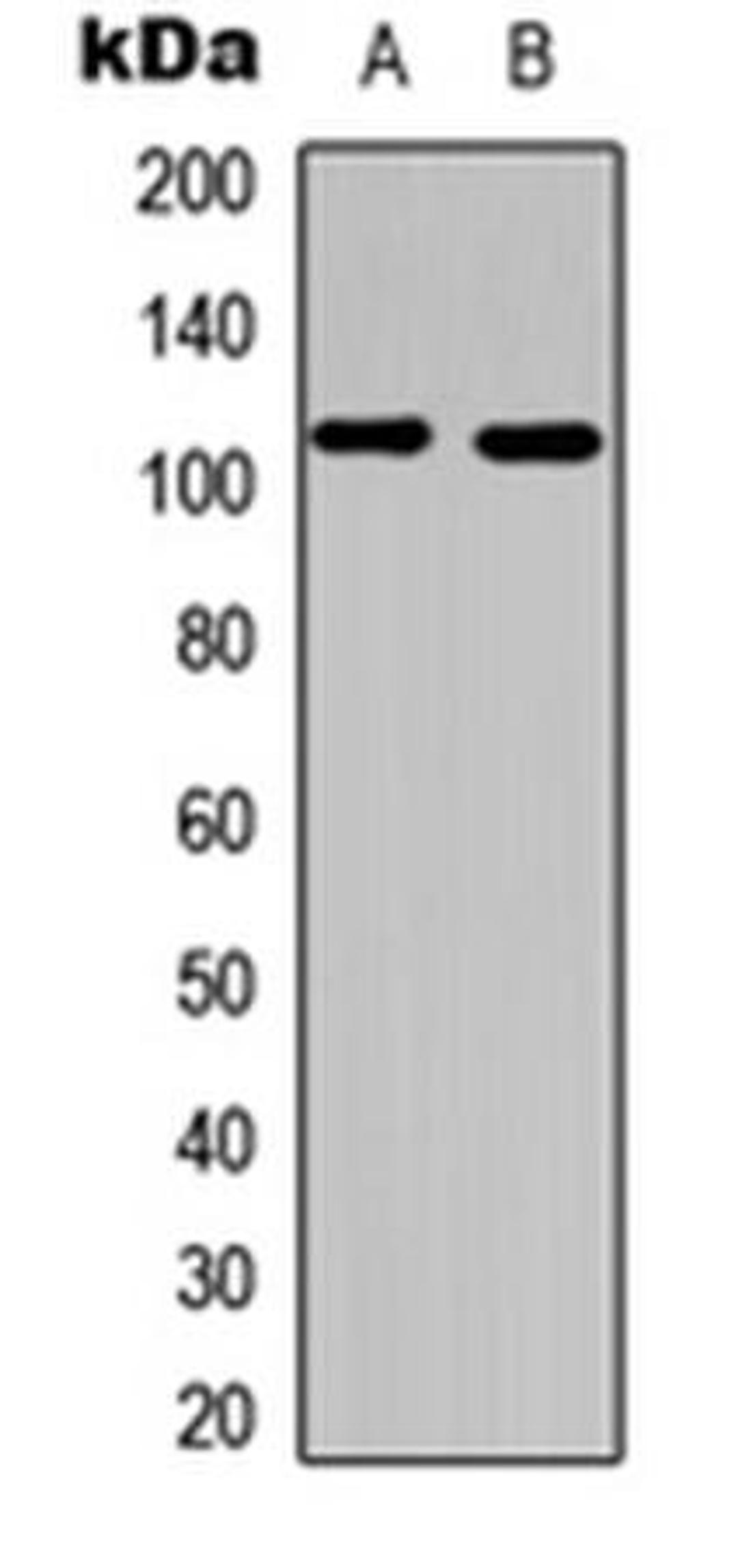 Western blot analysis of HeLa (Lane1), mouse liver (Lane2) whole cell using PI3K p110 alpha antibody