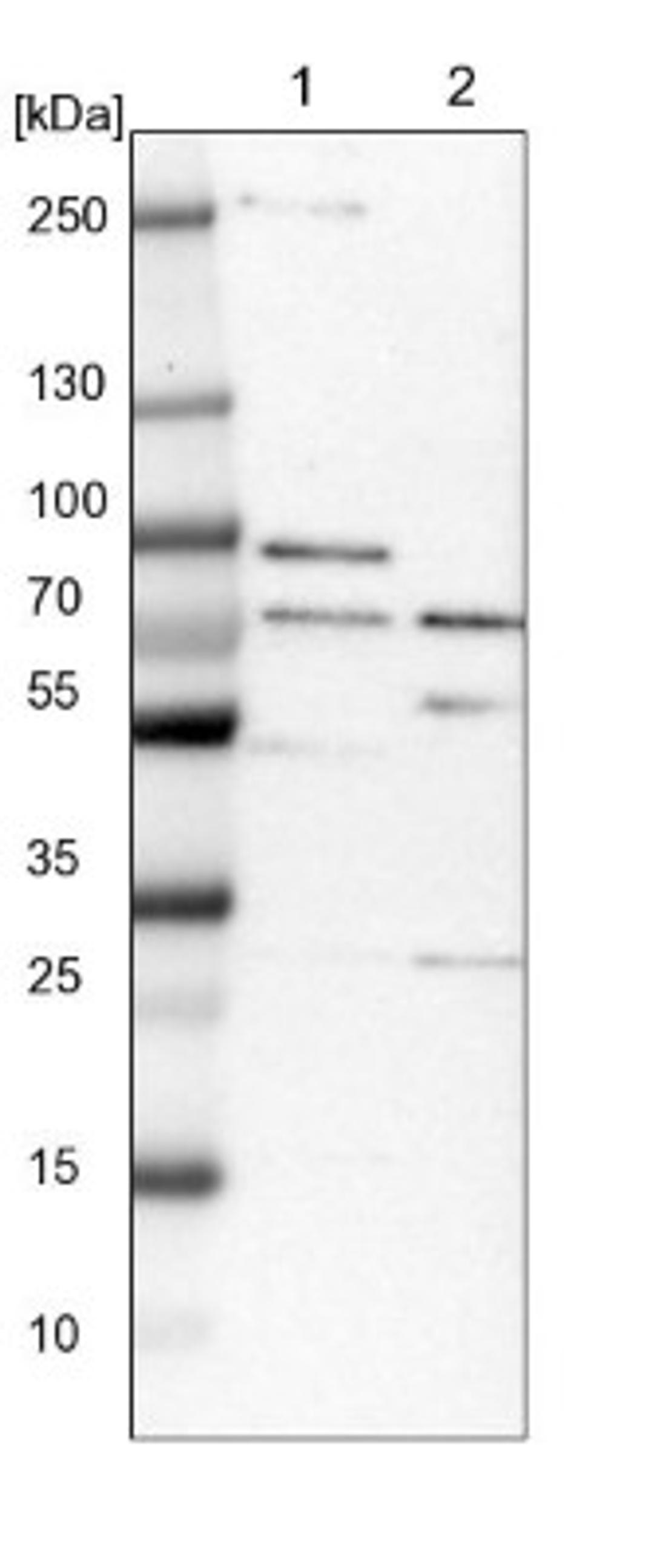 Western Blot: OGFOD1 Antibody [NBP1-83826] - Lane 1: NIH-3T3 cell lysate (Mouse embryonic fibroblast cells)<br/>Lane 2: NBT-II cell lysate (Rat Wistar bladder tumour cells)