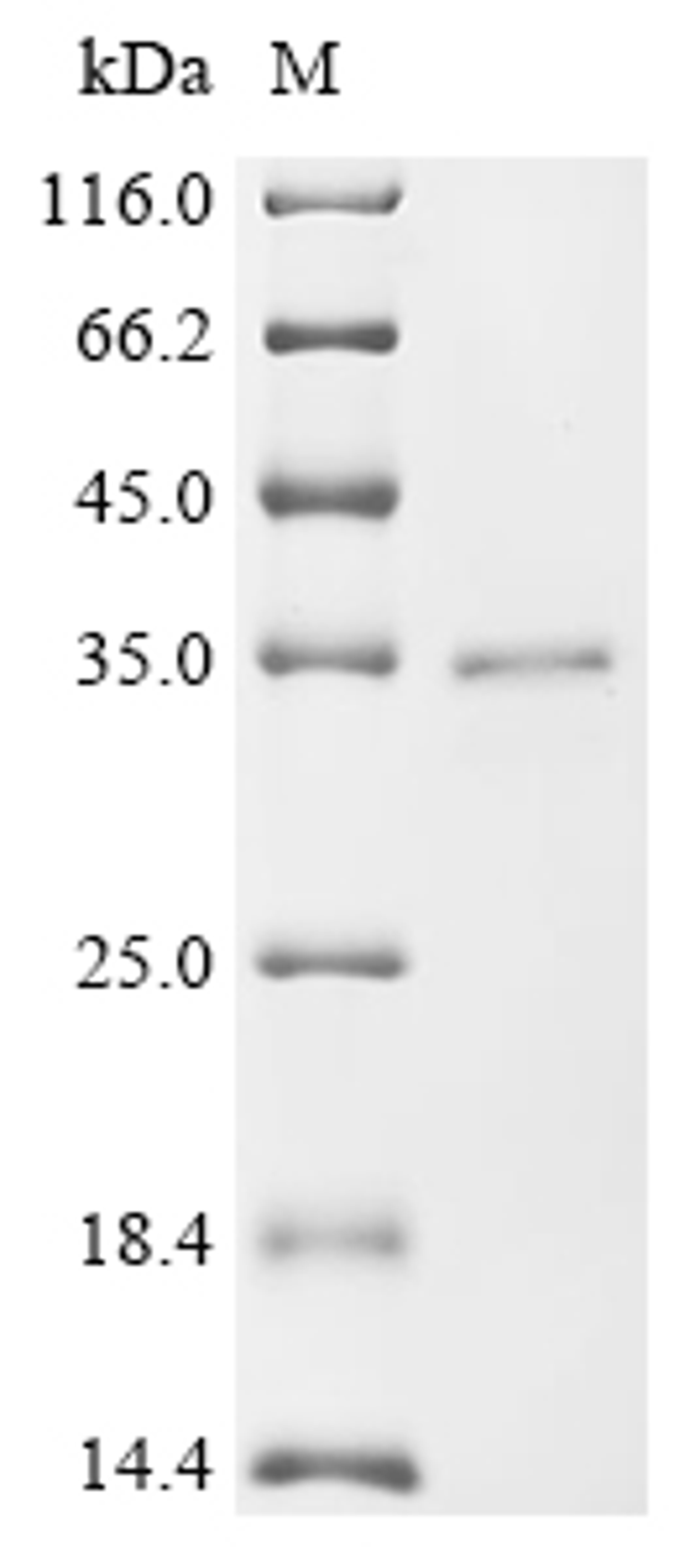 (Tris-Glycine gel) Discontinuous SDS-PAGE (reduced) with 5% enrichment gel and 15% separation gel.