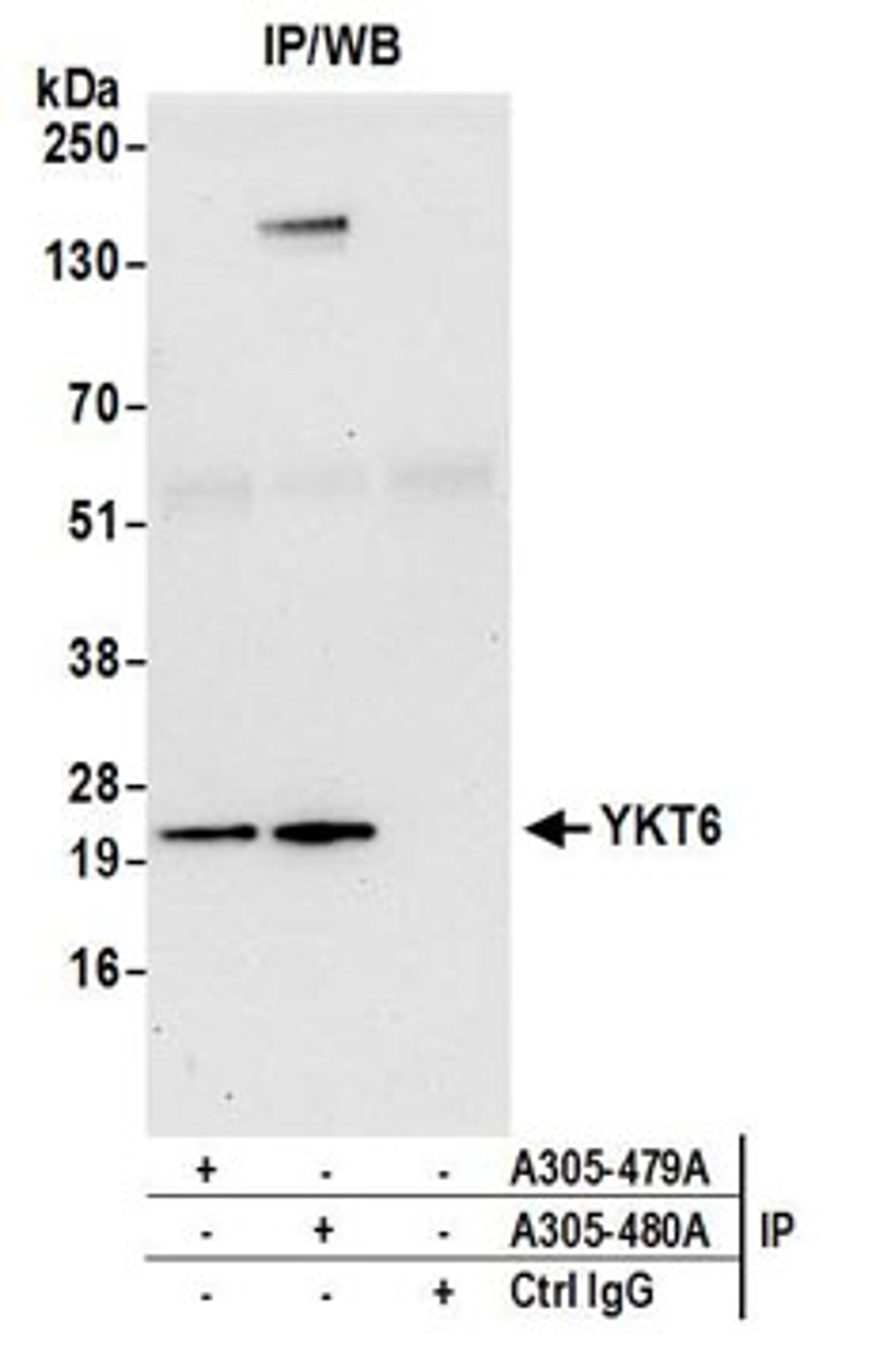 Detection of human YKT6 by western blot of immunoprecipitates.