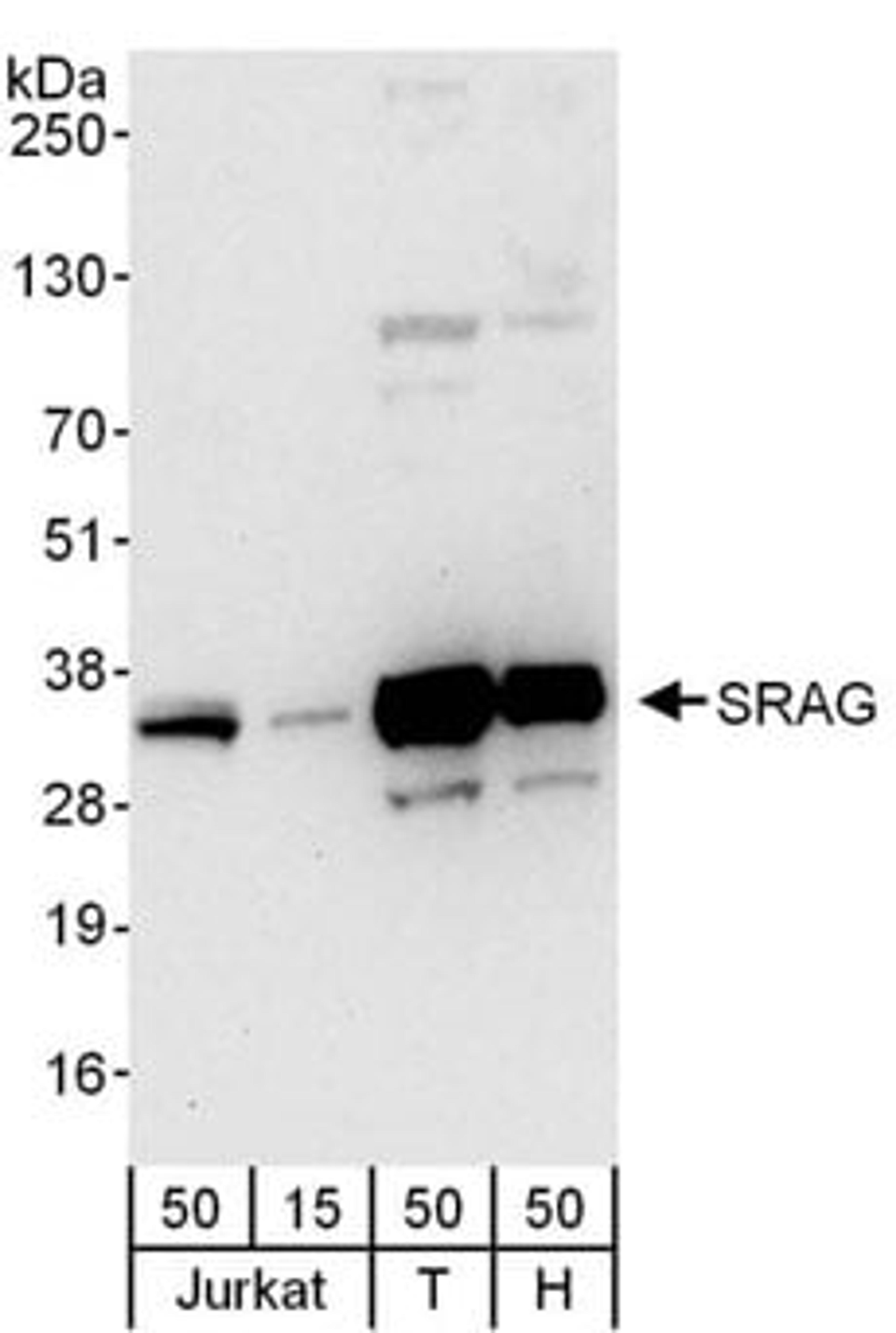 Detection of human SRAG by western blot.