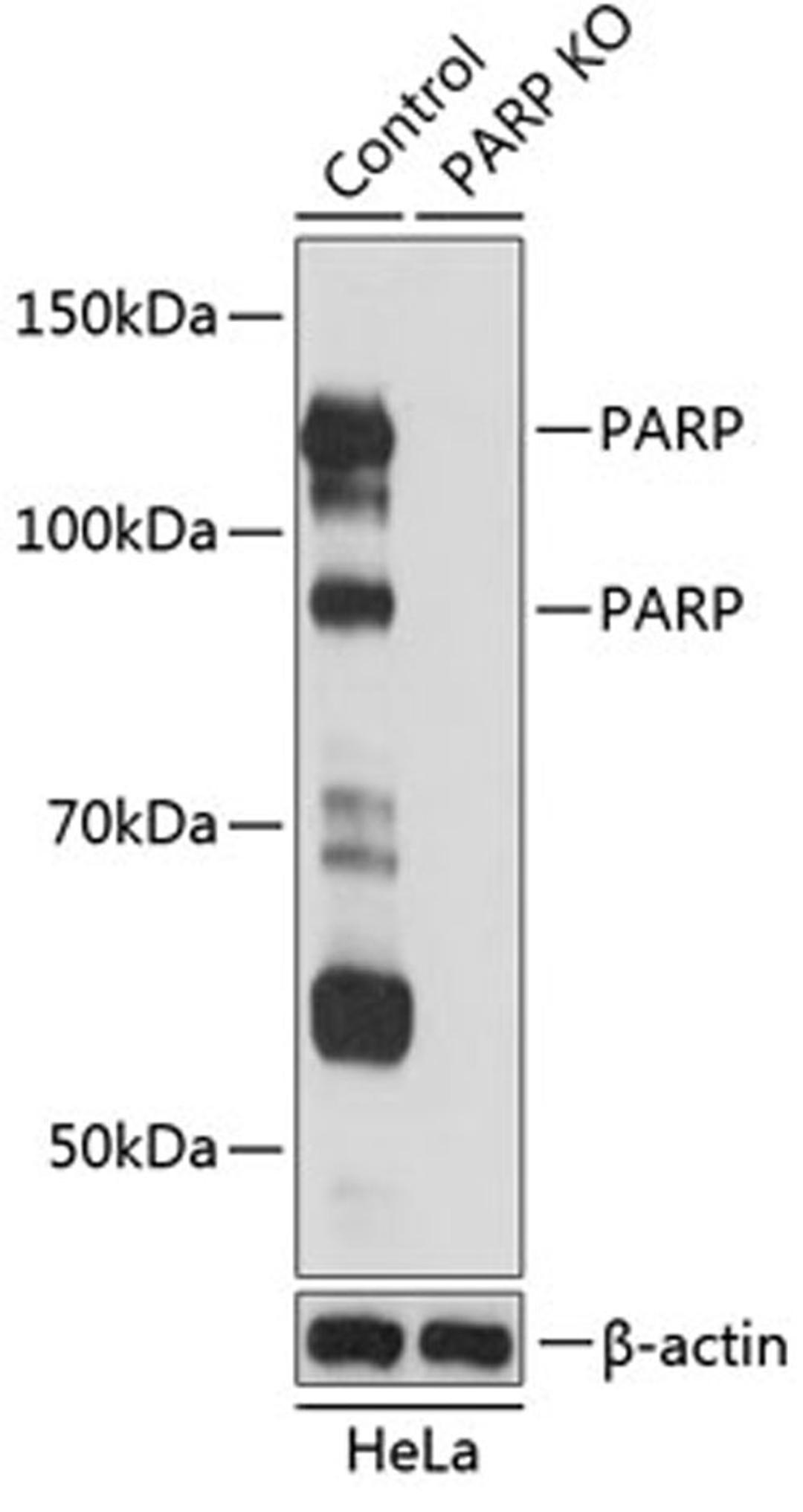 Western blot - PARP antibody (A19596)