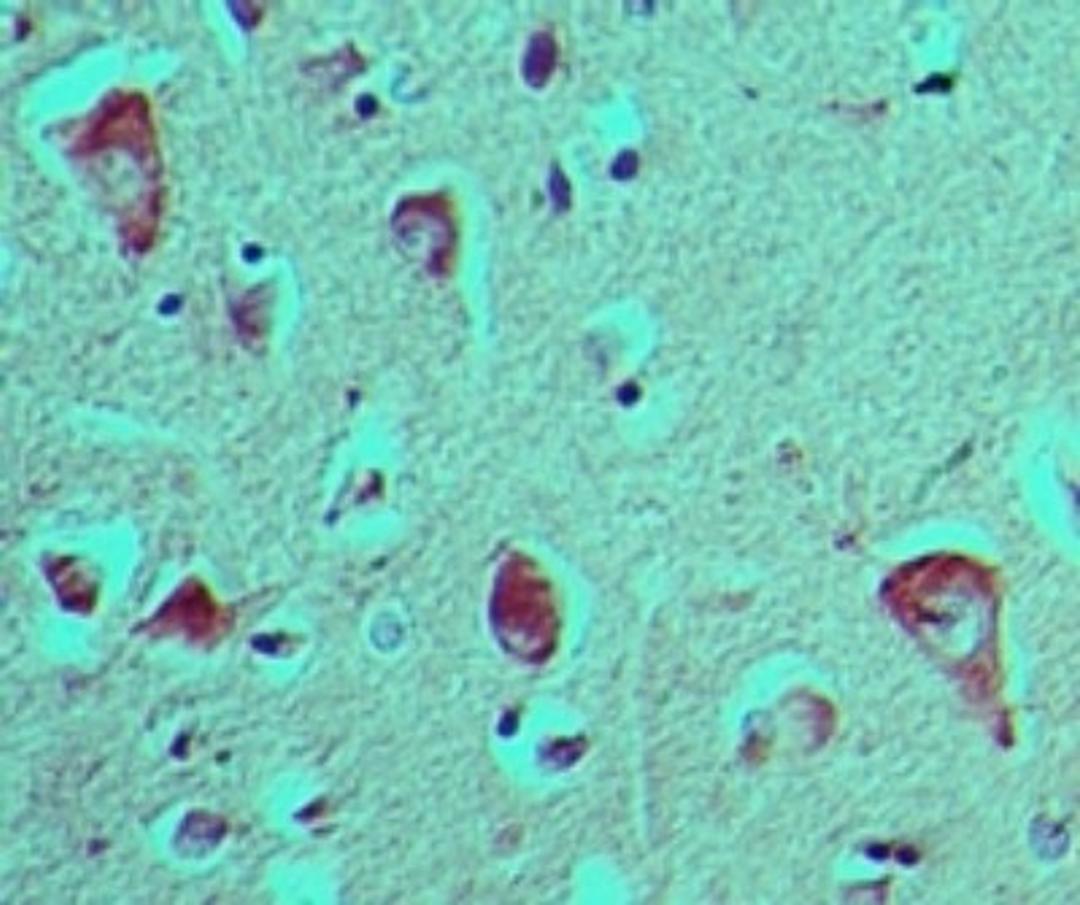 Immunohistochemistry-Paraffin: RAGE Antibody [NBP2-03950] - analysis of RAGE in formalin-fixed, paraffin-embedded human brain tissue using this antibody at 5 ug/ml.