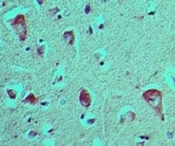 Immunohistochemistry-Paraffin: RAGE Antibody [NBP2-03950] - analysis of RAGE in formalin-fixed, paraffin-embedded human brain tissue using this antibody at 5 ug/ml.