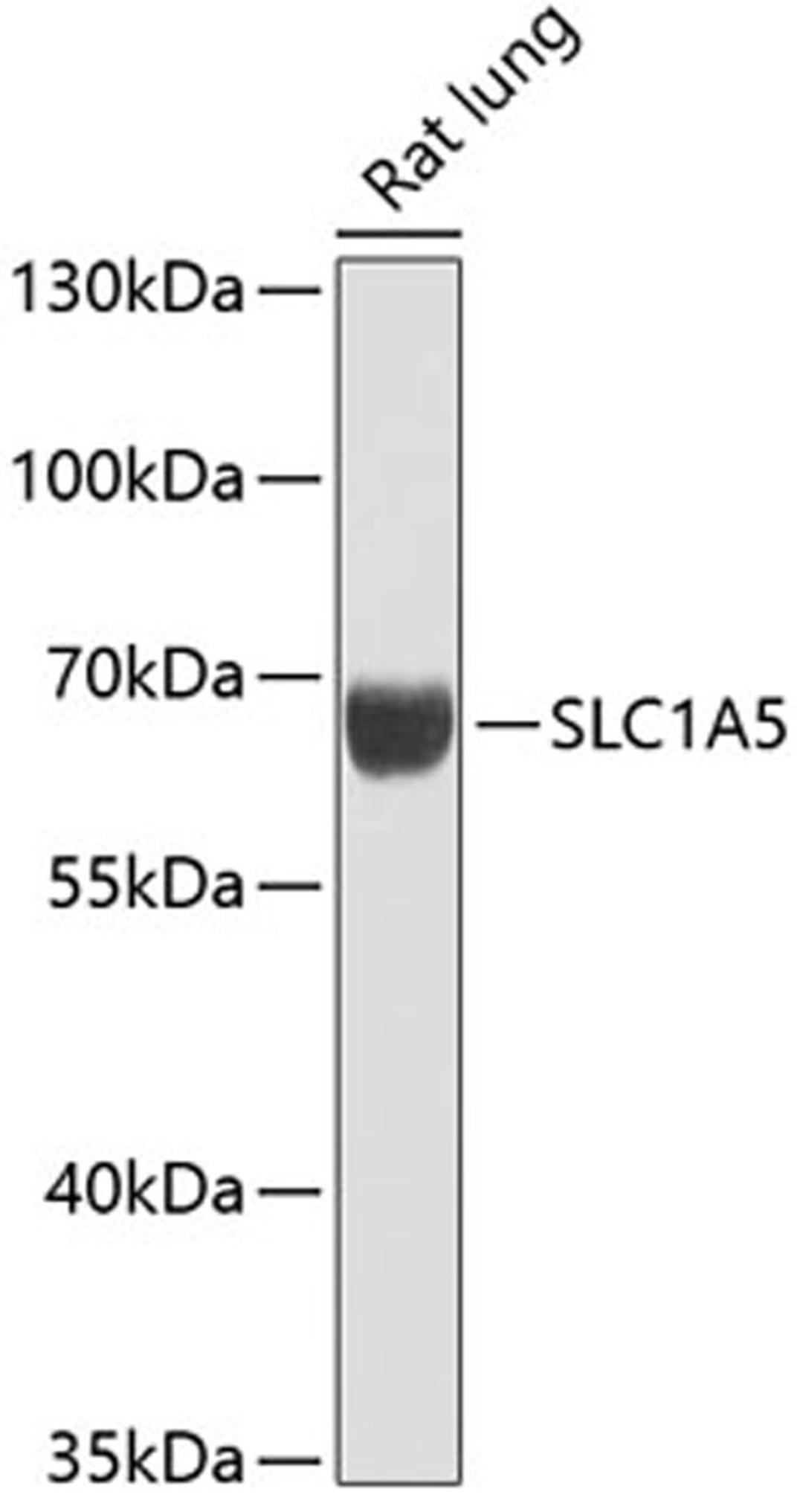 Western blot - SLC1A5 antibody (A12676)