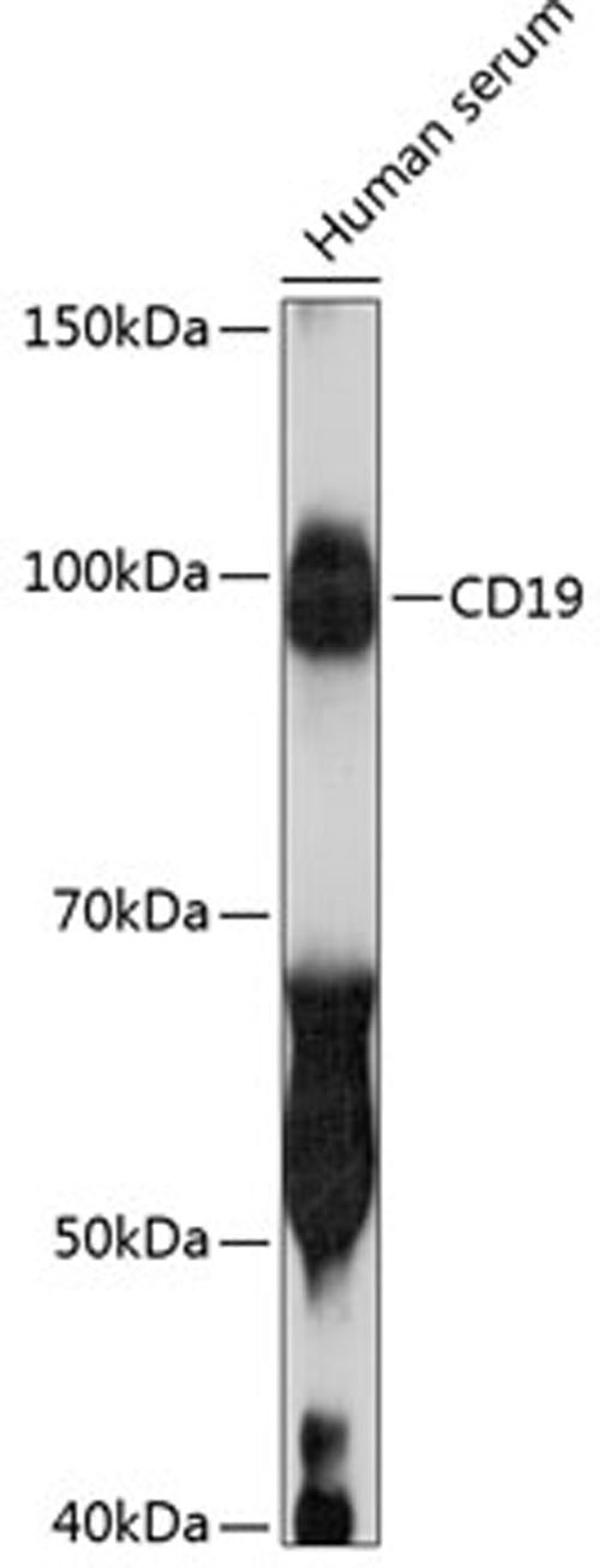 Western blot - CD19 antibody (A19013)