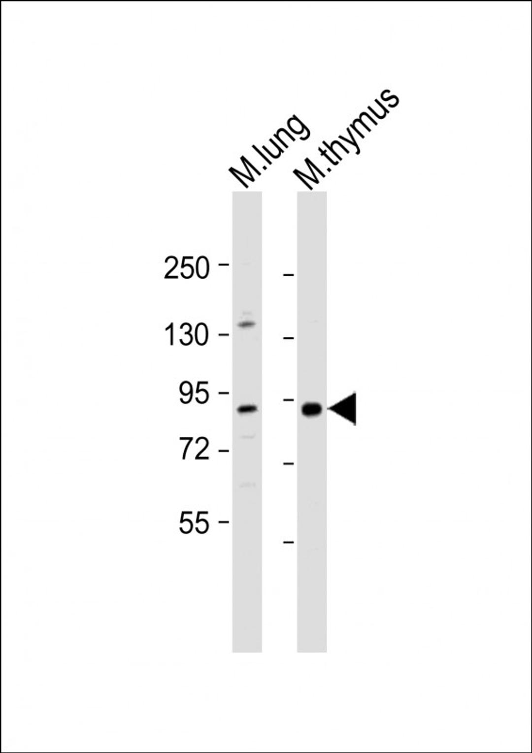 Western Blot at 1:1000 dilution Lane 1: mouse lung lysate Lane 2: mouse thymus lysate Lysates/proteins at 20 ug per lane.