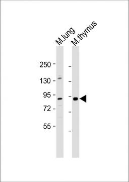 Western Blot at 1:1000 dilution Lane 1: mouse lung lysate Lane 2: mouse thymus lysate Lysates/proteins at 20 ug per lane.