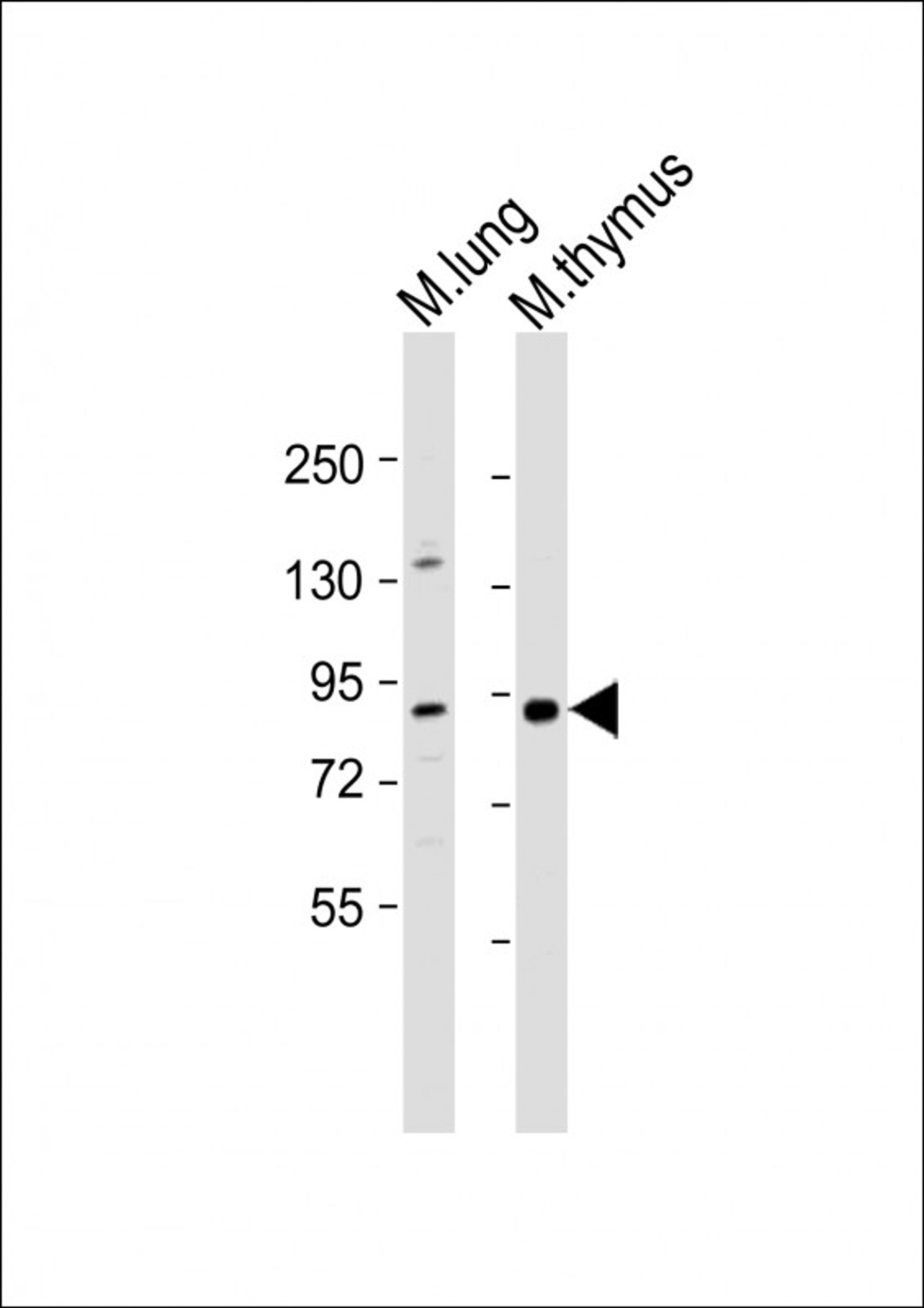 Western Blot at 1:1000 dilution Lane 1: mouse lung lysate Lane 2: mouse thymus lysate Lysates/proteins at 20 ug per lane.