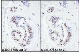 Detection of human KAP-1 by immunohistochemistry.