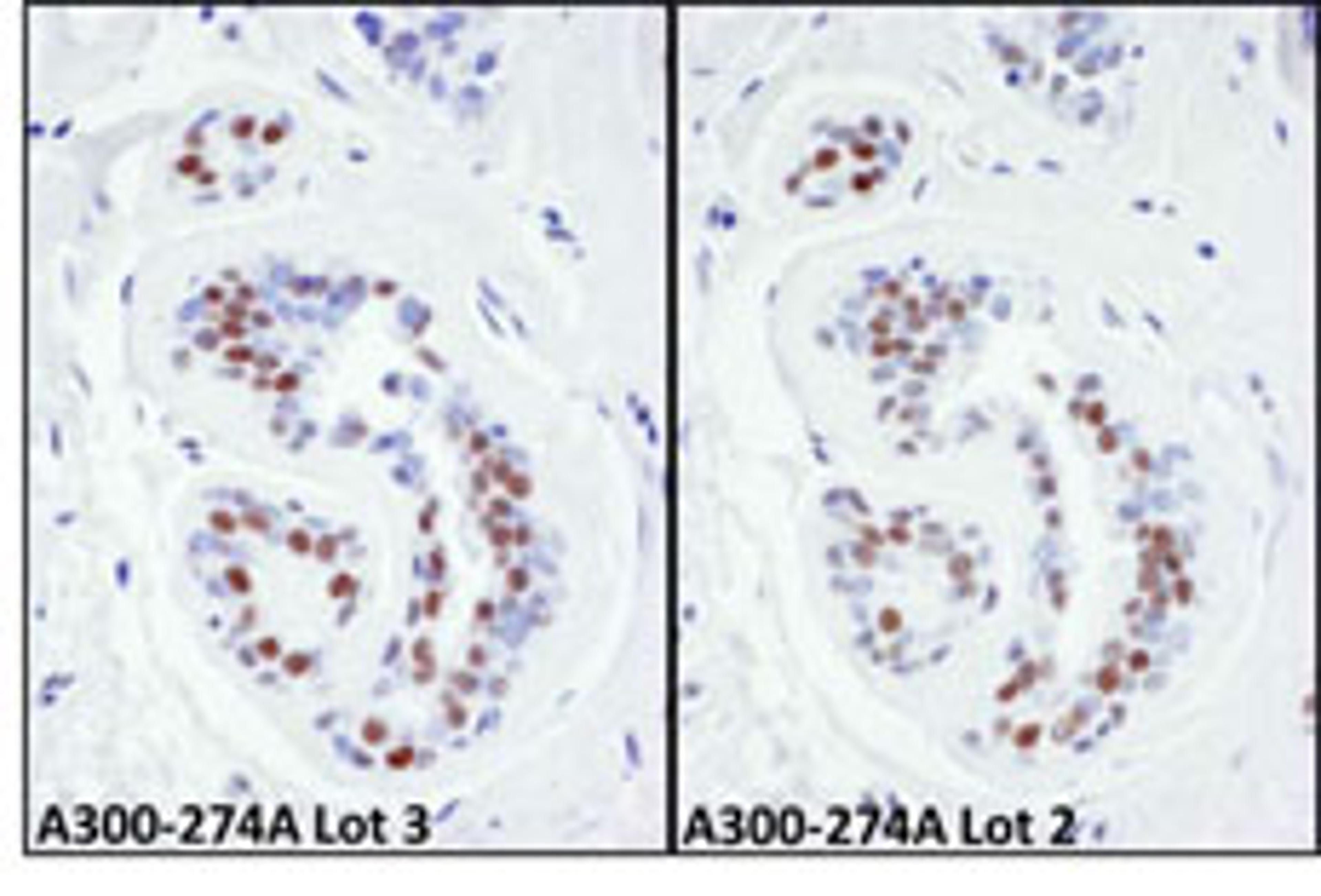 Detection of human KAP-1 by immunohistochemistry.