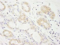 Detection of human eIF2A by immunohistochemistry.