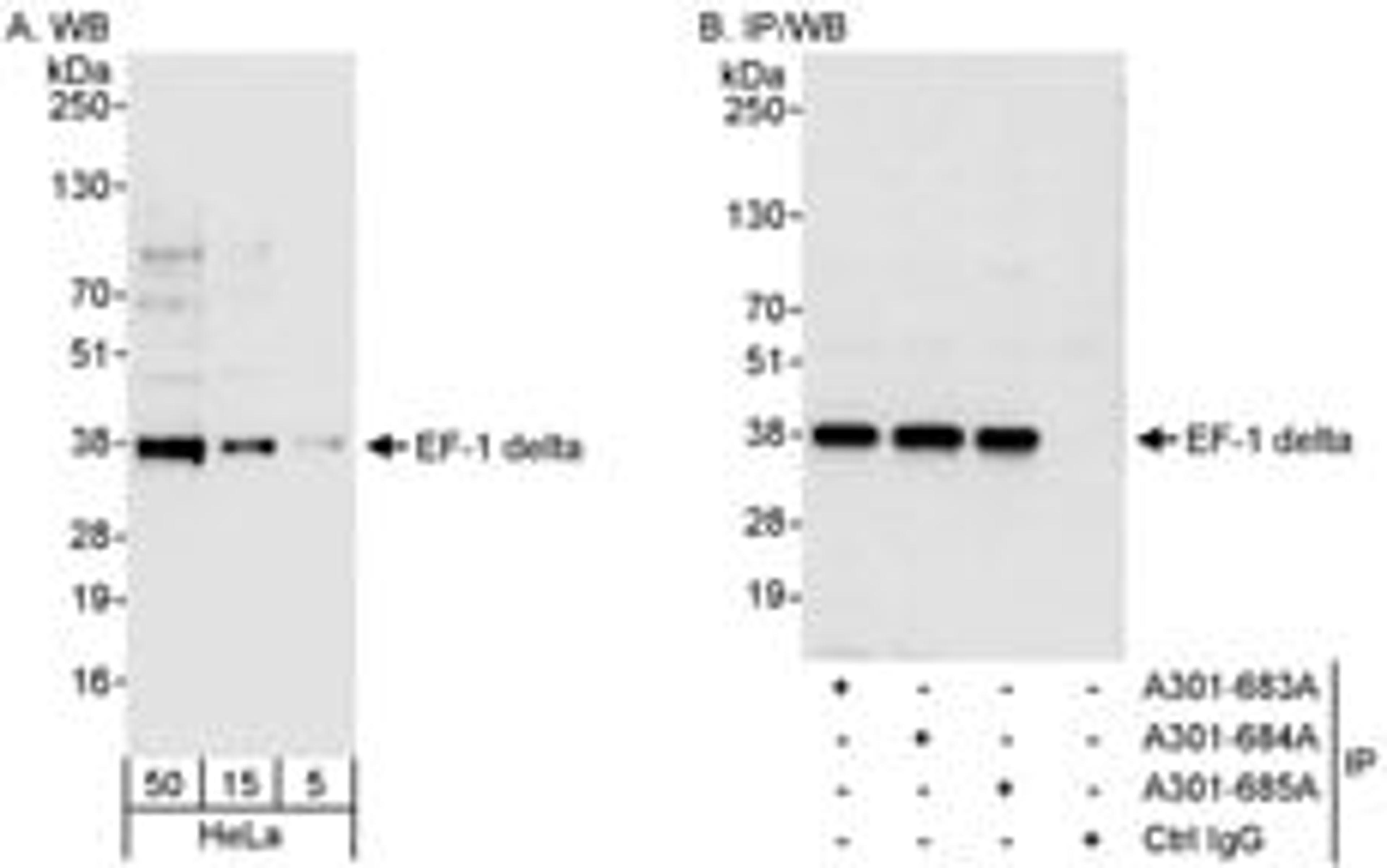 Detection of human EF-1 delta by western blot and immunoprecipitation.