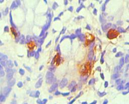 Immunohistochemical of paraffin-embedded Human small intestine tissue using CSB-MA0053441A0m(1D7-3D5) at dilution of 1:200.