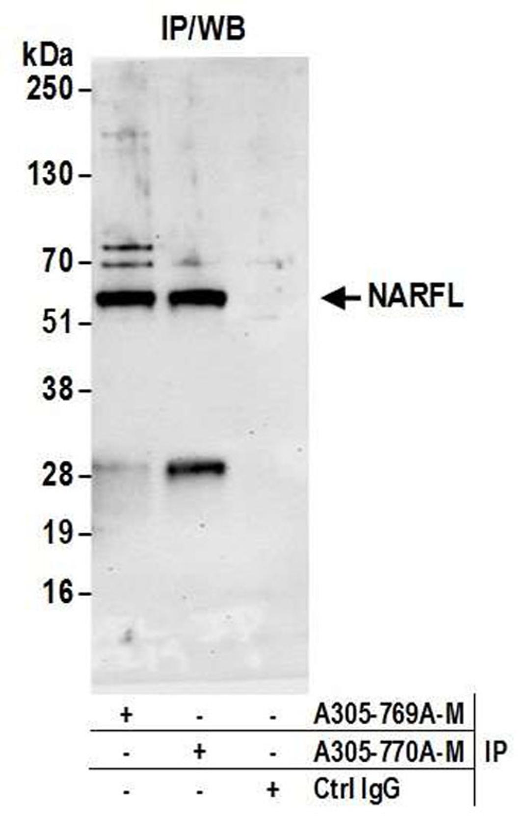 Detection of Human NARFL by WB of IP.