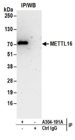 Detection of human METTL16 by western blot of immunoprecipitates.