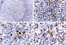 Immunohistochemistry-Paraffin: MALT1 Antibody [NB100-56158] - analysis of MALT1/Paracaspase expression in formalin-fixed human reactive lymph node using this antibody at 1:2000. A. Low magnification. A1-3, high magnification from A: A1, mantle zone. A2, germinal center. A3. marginal zone. Hematoxylin-eosin counterstain.