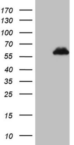 Western Blot: ZFP200 Antibody (5F4) [NBP2-46423] - Analysis of HEK293T cells were transfected with the pCMV6-ENTRY control (Left lane) or pCMV6-ENTRY ZNF200.