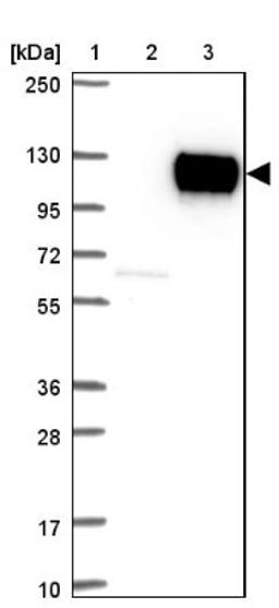 Western Blot: Cadherin-17 Antibody [NBP1-88238] - Lane 1: Marker [kDa] 250, 130, 95, 72, 55, 36, 28, 17, 10<br/>Lane 2: Negative control (vector only transfected HEK293T lysate)<br/>Lane 3: Over-expression lysate (Co-expressed with a C-terminal myc-DDK tag (~3.1 kDa) in mammalian HEK293T cells, LY418246)