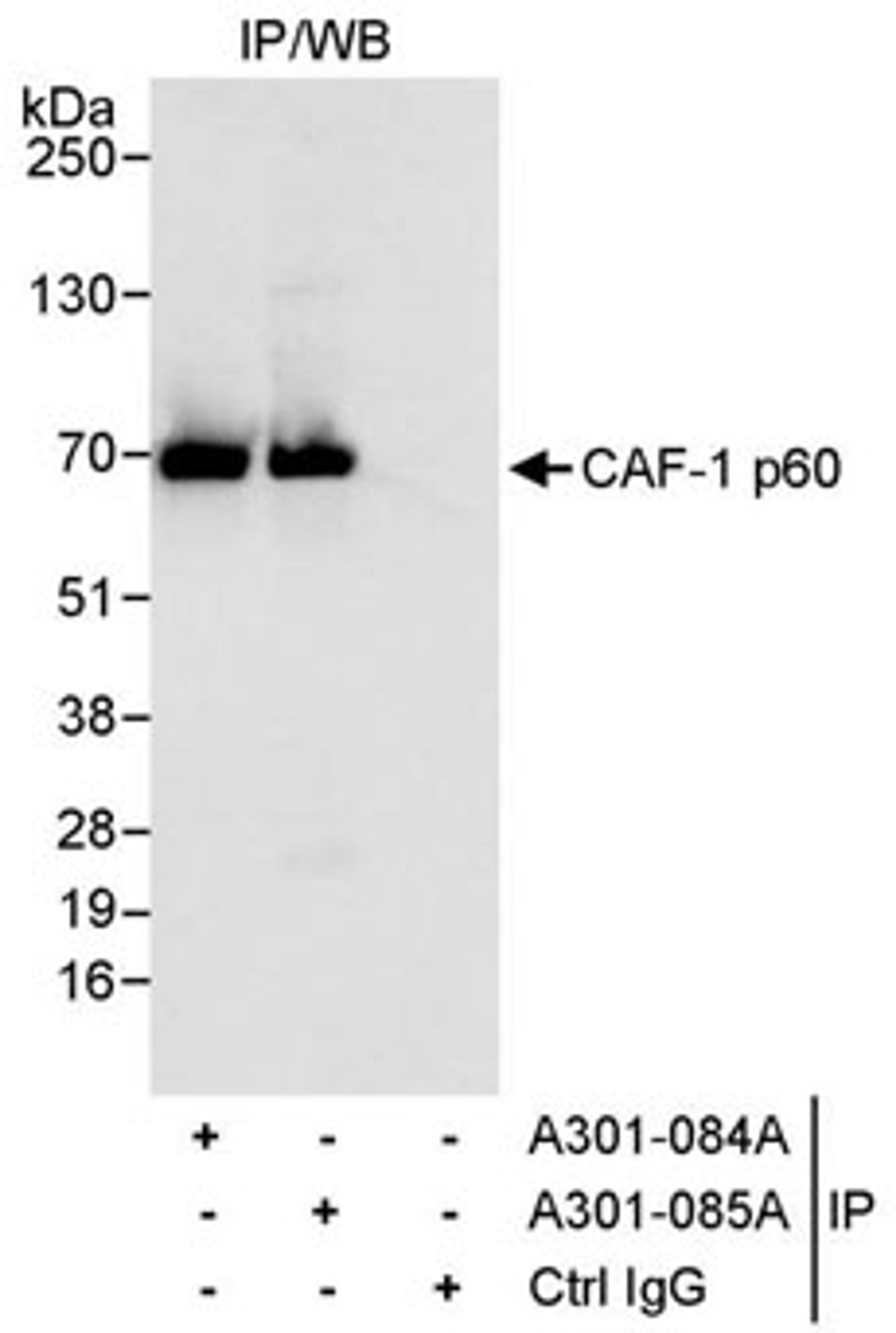 Detection of human CAF-1 p60 by western blot and immunoprecipitation.