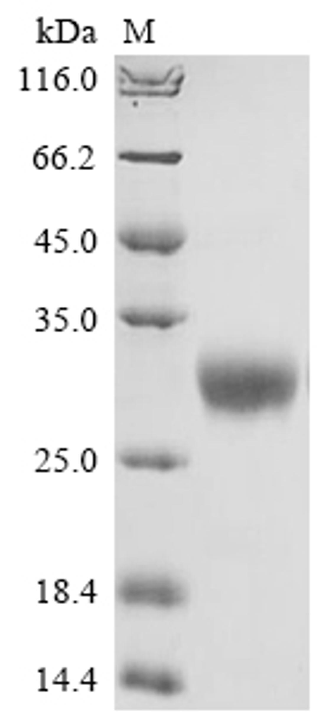 (Tris-Glycine gel) Discontinuous SDS-PAGE (reduced) with 5% enrichment gel and 15% separation gel.