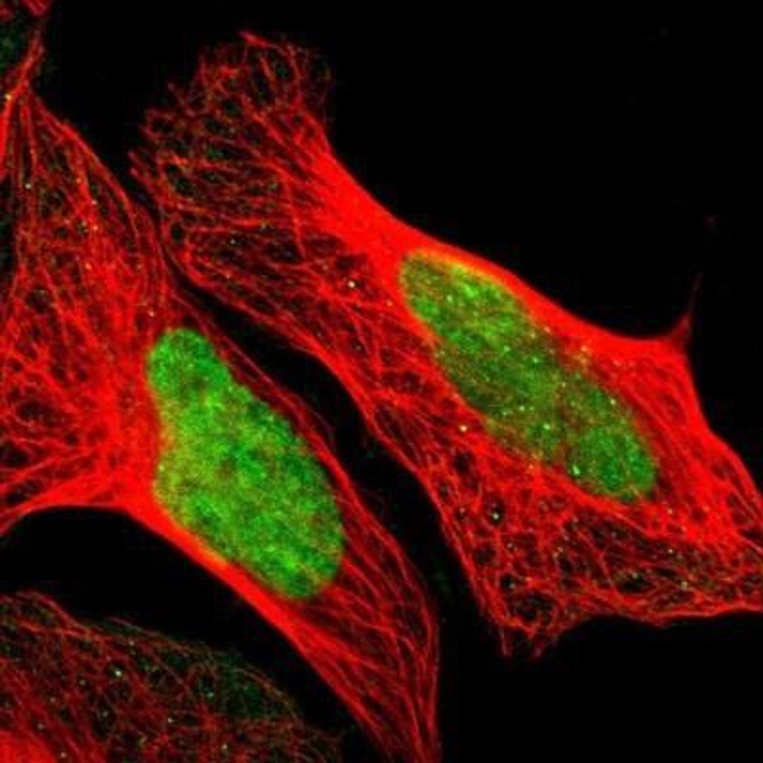 Immunocytochemistry: POGZ Antibody [NBP1-83004] -  Staining of human cell line U-2 OS shows positivity in nucleus.