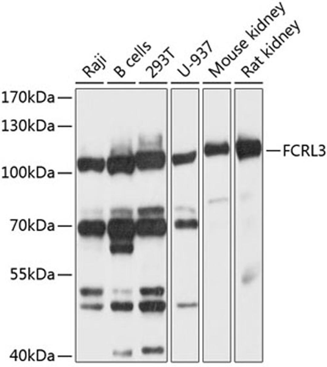 Western blot - FCRL3 antibody (A10451)