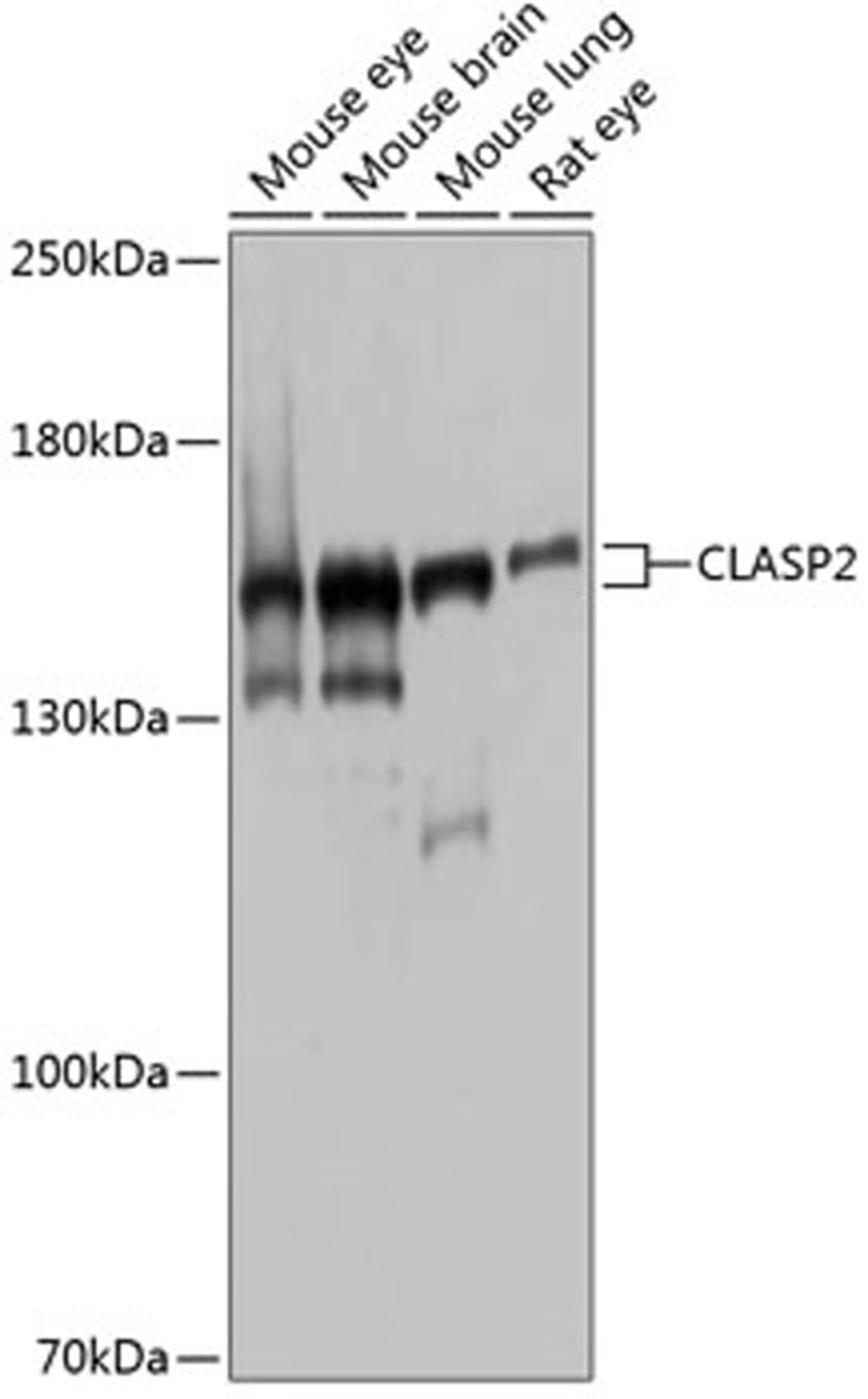 Western blot - CLASP2 antibody (A4528)