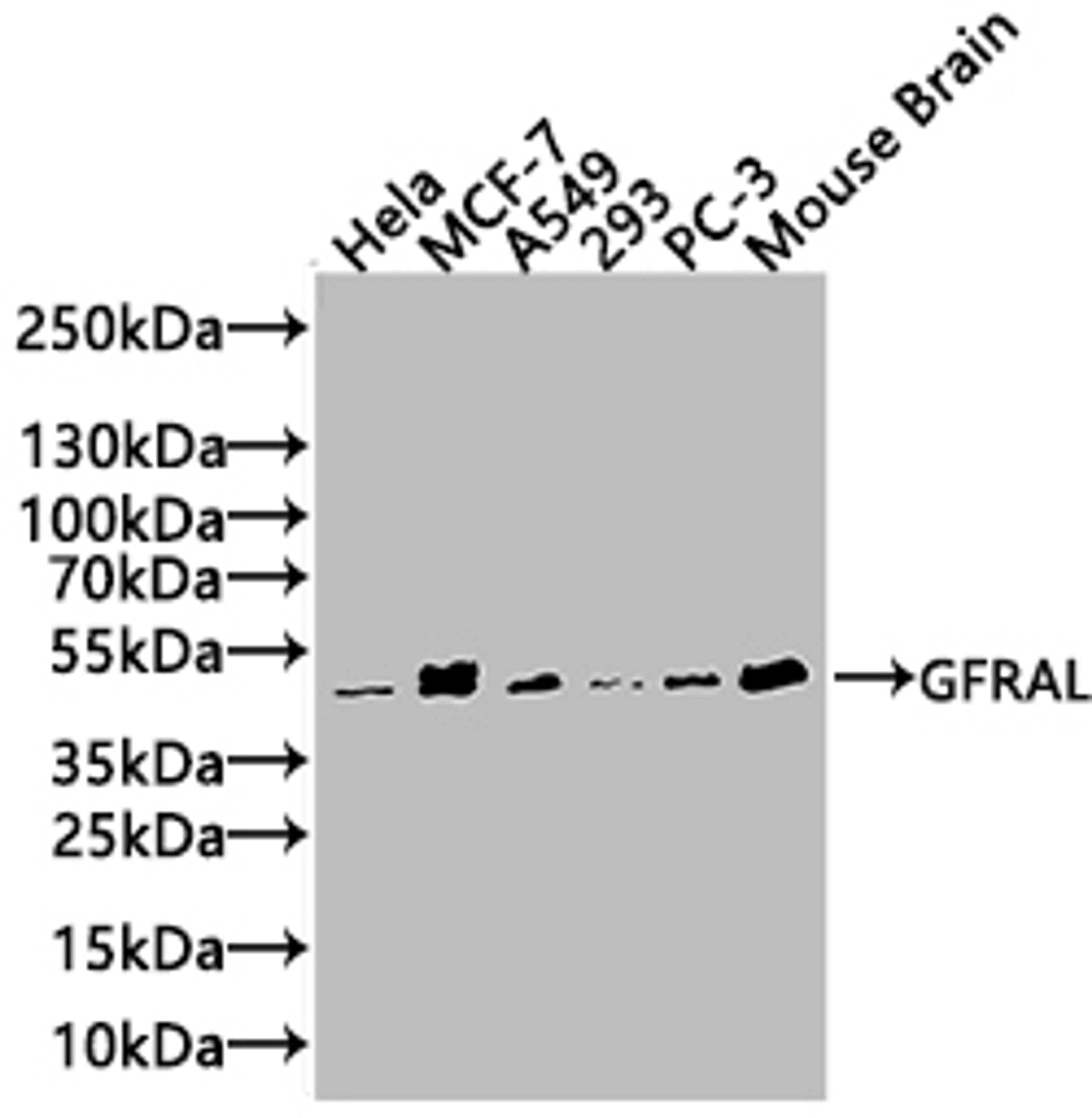 Western Blot. Positive WB detected in:Mouse Liver tissue lysate. All lanes: GFRAL antibody at 1:1000. Secondary. Goat polyclonal to rabbit IgG at 1/50000 dilution. Predicted band size: 45 kDa. Observed band size: 55 kDa. 