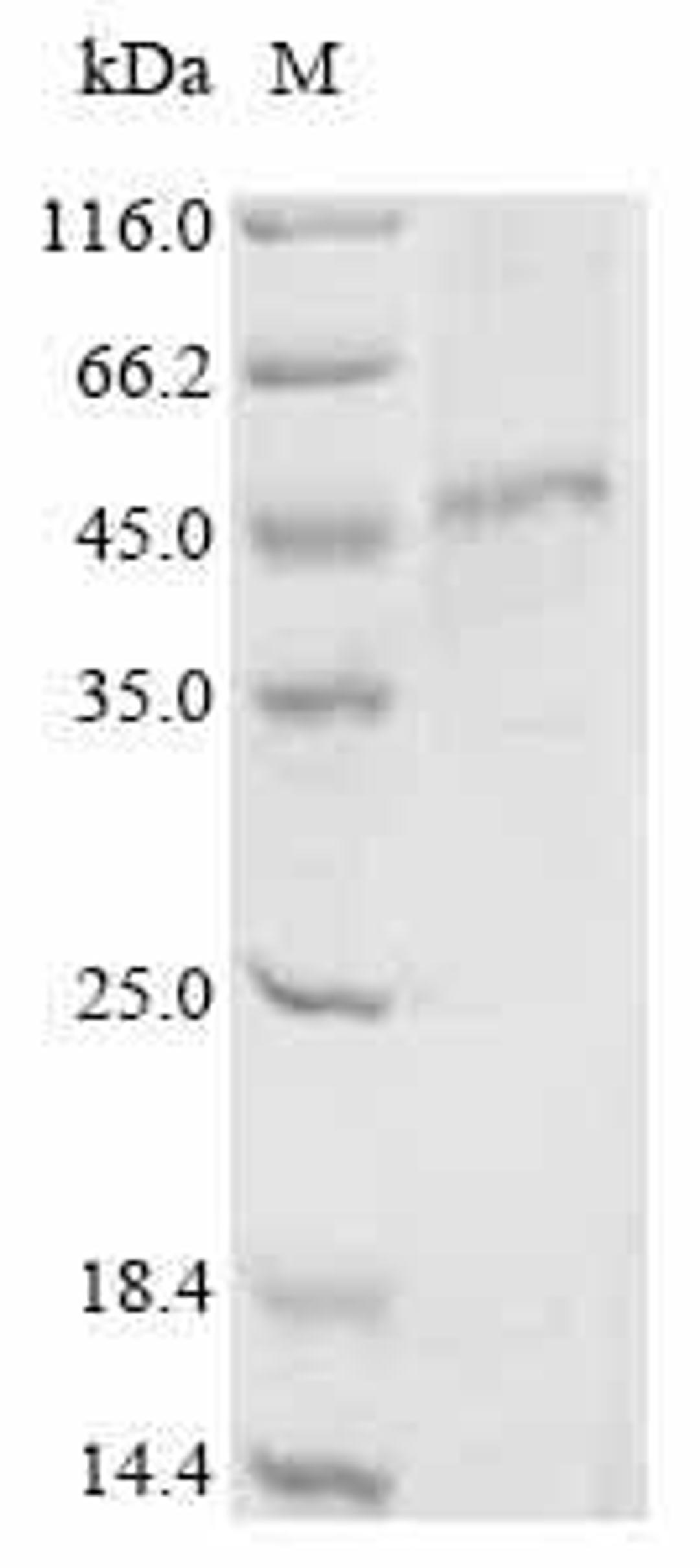 (Tris-Glycine gel) Discontinuous SDS-PAGE (reduced) with 5% enrichment gel and 15% separation gel.