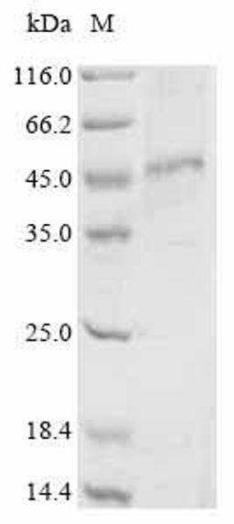 (Tris-Glycine gel) Discontinuous SDS-PAGE (reduced) with 5% enrichment gel and 15% separation gel.