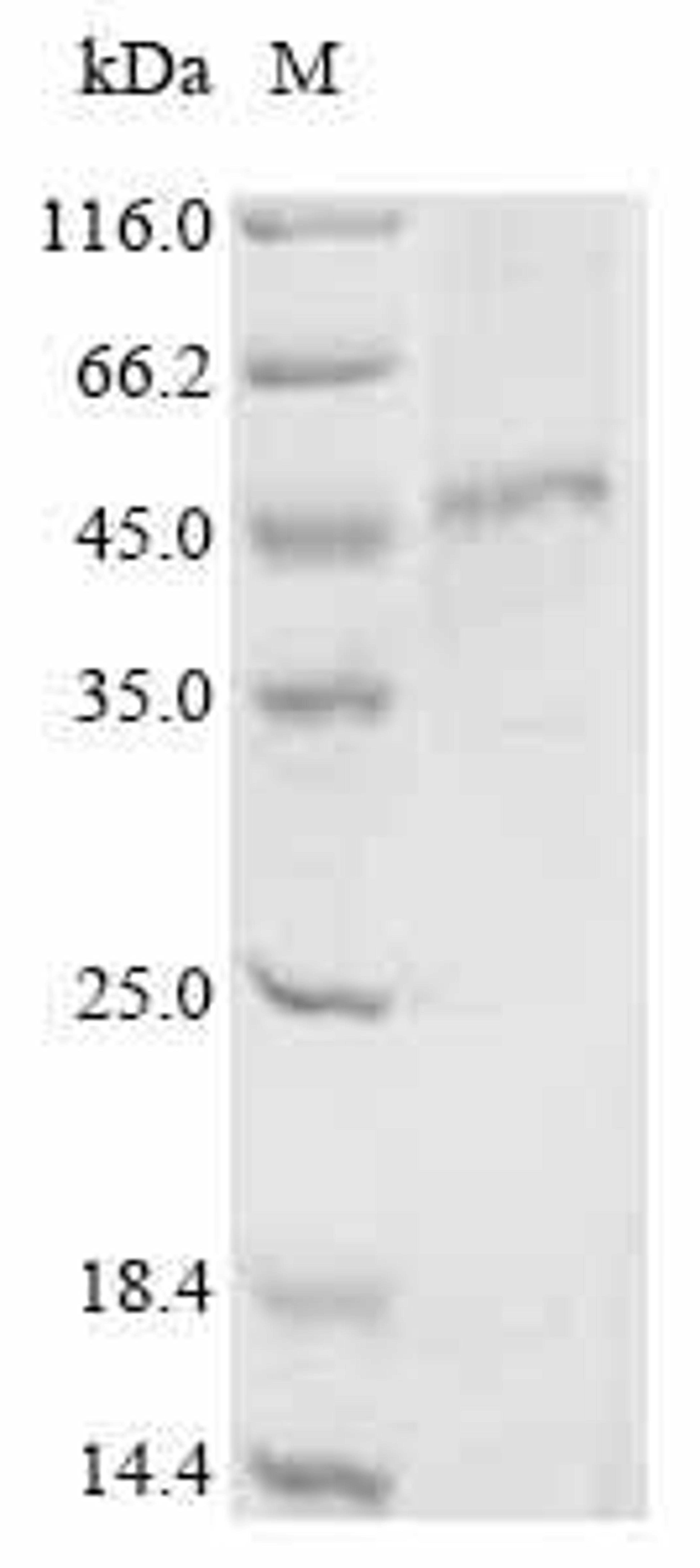 (Tris-Glycine gel) Discontinuous SDS-PAGE (reduced) with 5% enrichment gel and 15% separation gel.