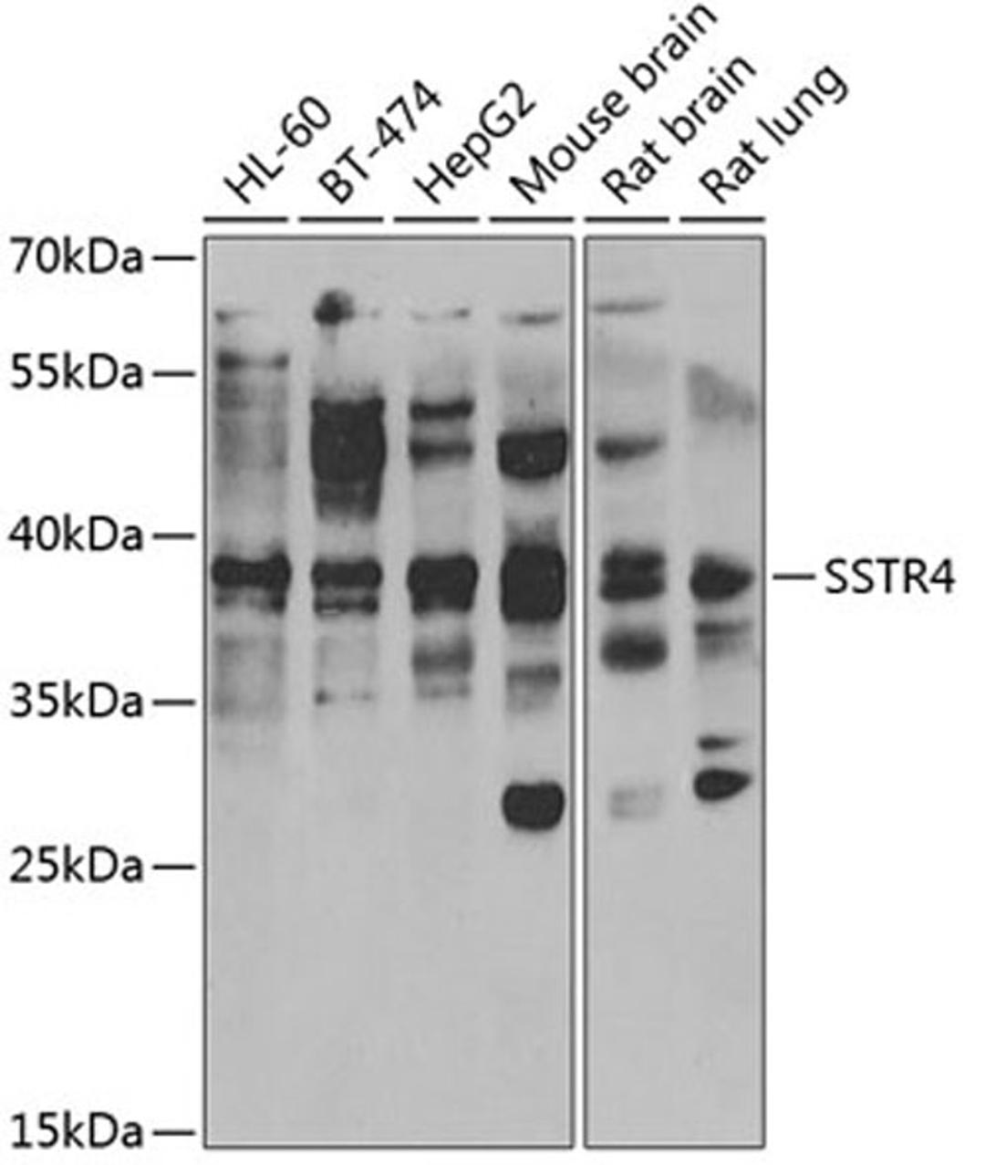 Western blot - SSTR4 antibody (A6988)