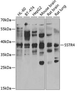 Western blot - SSTR4 antibody (A6988)