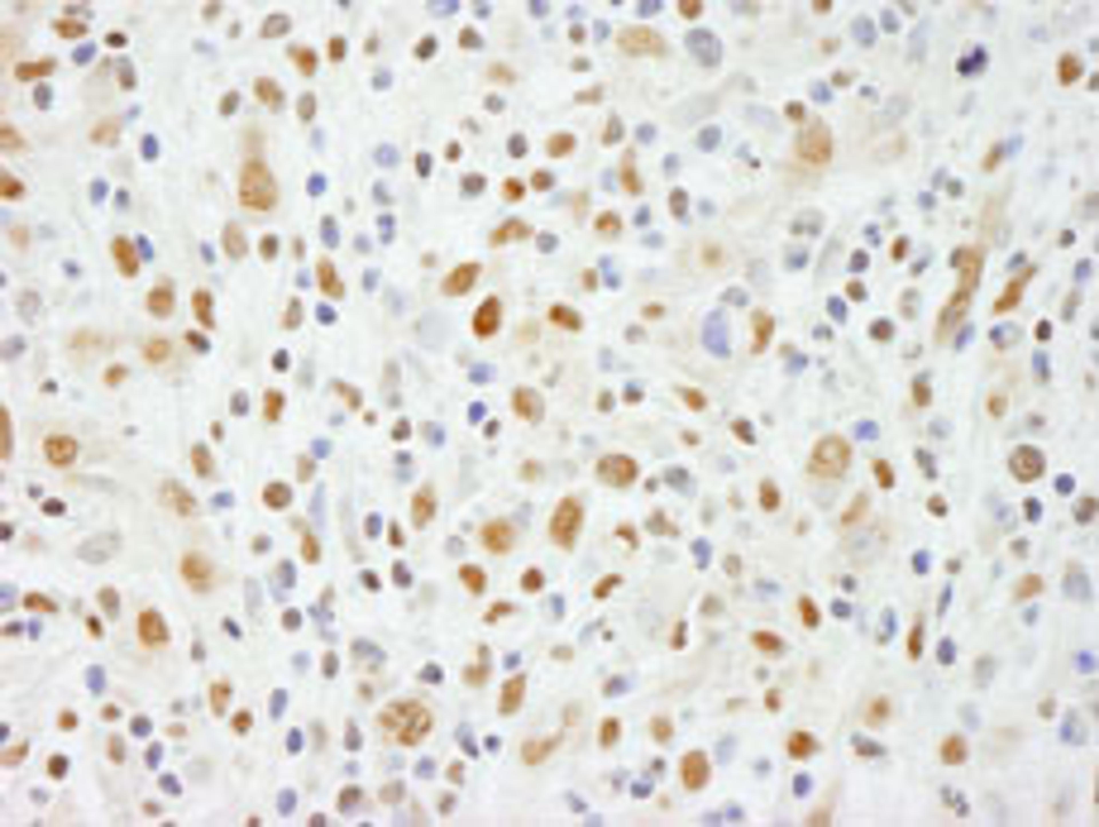 Detection of human NIF1 by immunohistochemistry.