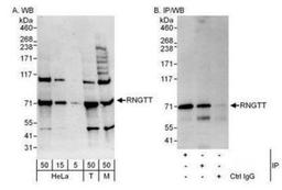 Western Blot: RNGTT Antibody [NBP1-49973] - Detection of Human and Mouse RNGTT by Western Blot (h&m) and Immunoprecipitation (h).  Samples: Whole cell lysate from HeLa (5, 15 and 50 mcg for WB; 1 mg for IP, 20% of IP loaded), 293T (T; 50 mcg), and mouse NIH3T3 (M; 50 mcg) cells.  Antibodies: Affinity purified rabbit anti-RNGTT antibody used for WB at 0.04 mcg/ml (A) and 0.4 mcg/ml (B) and used for IP at 3 mcg/mg lysate.  RNGTT was also immunoprecipitated by rabbit anti-RNGTT antibody which recognizes an upstream epitope.  For blotting immunoprecipitated RNGTT was used.  Detection: Chemiluminescence with exposure times of 3 minutes (A) and 30 seconds (B).