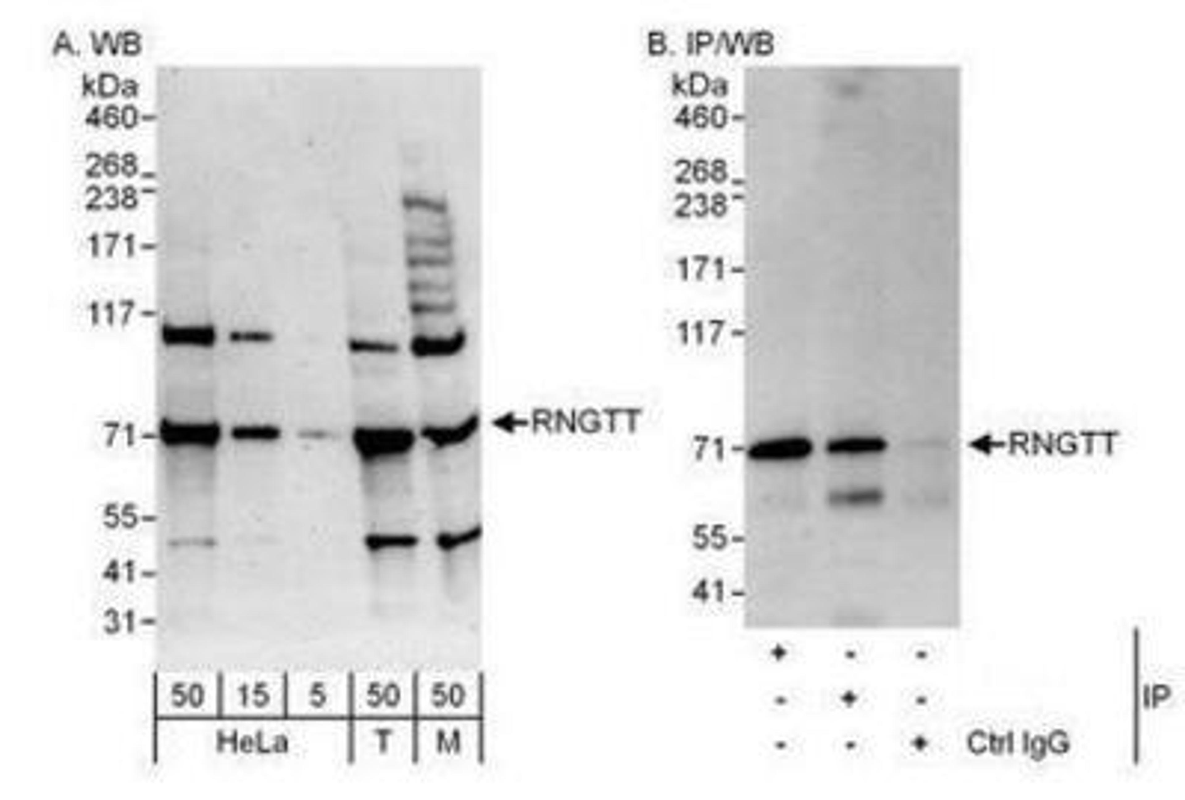 Western Blot: RNGTT Antibody [NBP1-49973] - Detection of Human and Mouse RNGTT by Western Blot (h&m) and Immunoprecipitation (h).  Samples: Whole cell lysate from HeLa (5, 15 and 50 mcg for WB; 1 mg for IP, 20% of IP loaded), 293T (T; 50 mcg), and mouse NIH3T3 (M; 50 mcg) cells.  Antibodies: Affinity purified rabbit anti-RNGTT antibody used for WB at 0.04 mcg/ml (A) and 0.4 mcg/ml (B) and used for IP at 3 mcg/mg lysate.  RNGTT was also immunoprecipitated by rabbit anti-RNGTT antibody which recognizes an upstream epitope.  For blotting immunoprecipitated RNGTT was used.  Detection: Chemiluminescence with exposure times of 3 minutes (A) and 30 seconds (B).