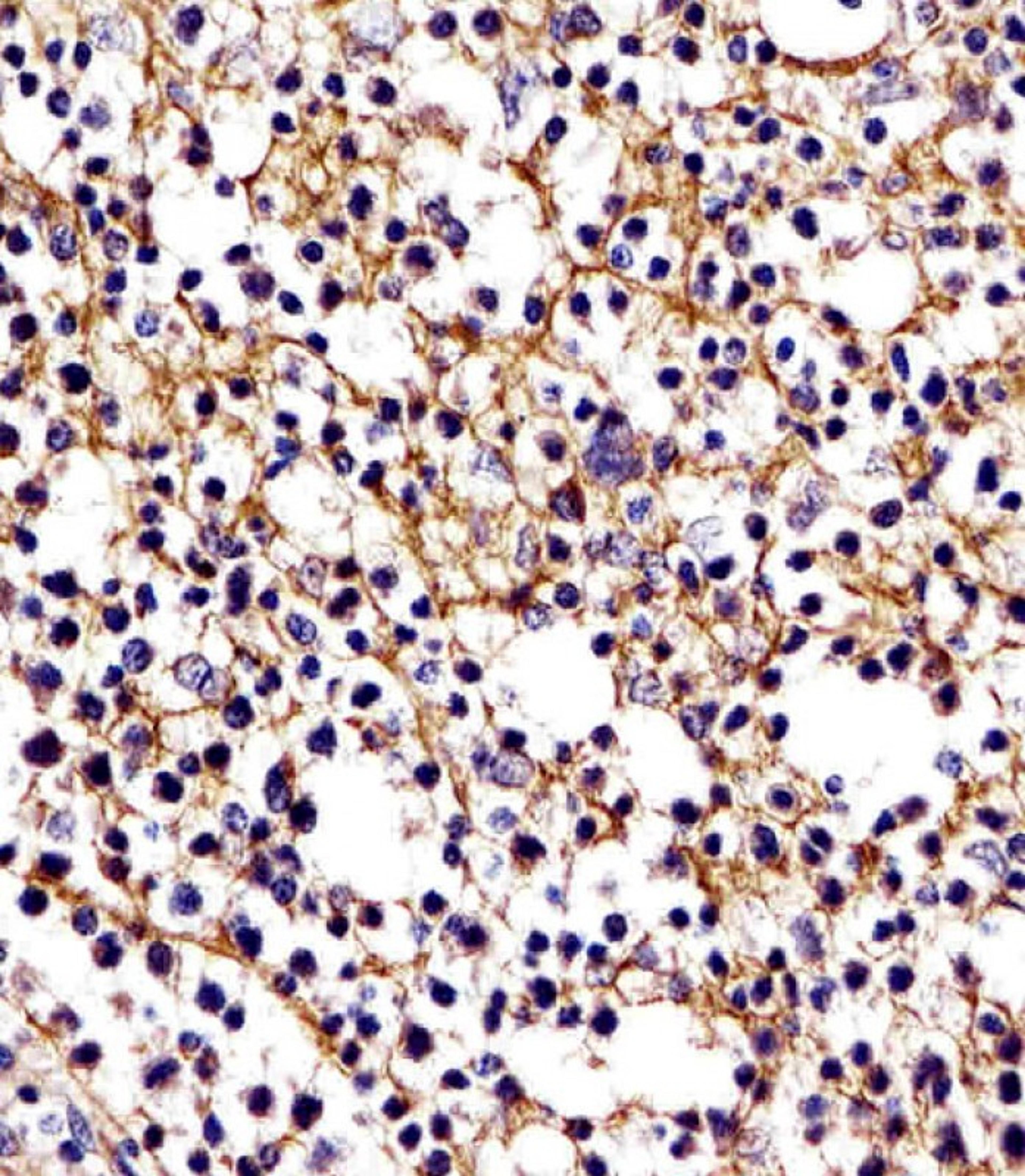 Antibody staining D11b in human tonsil tissue sections by Immunohistochemistry (IHC-P - paraformaldehyde-fixed, paraffin-embedded sections).