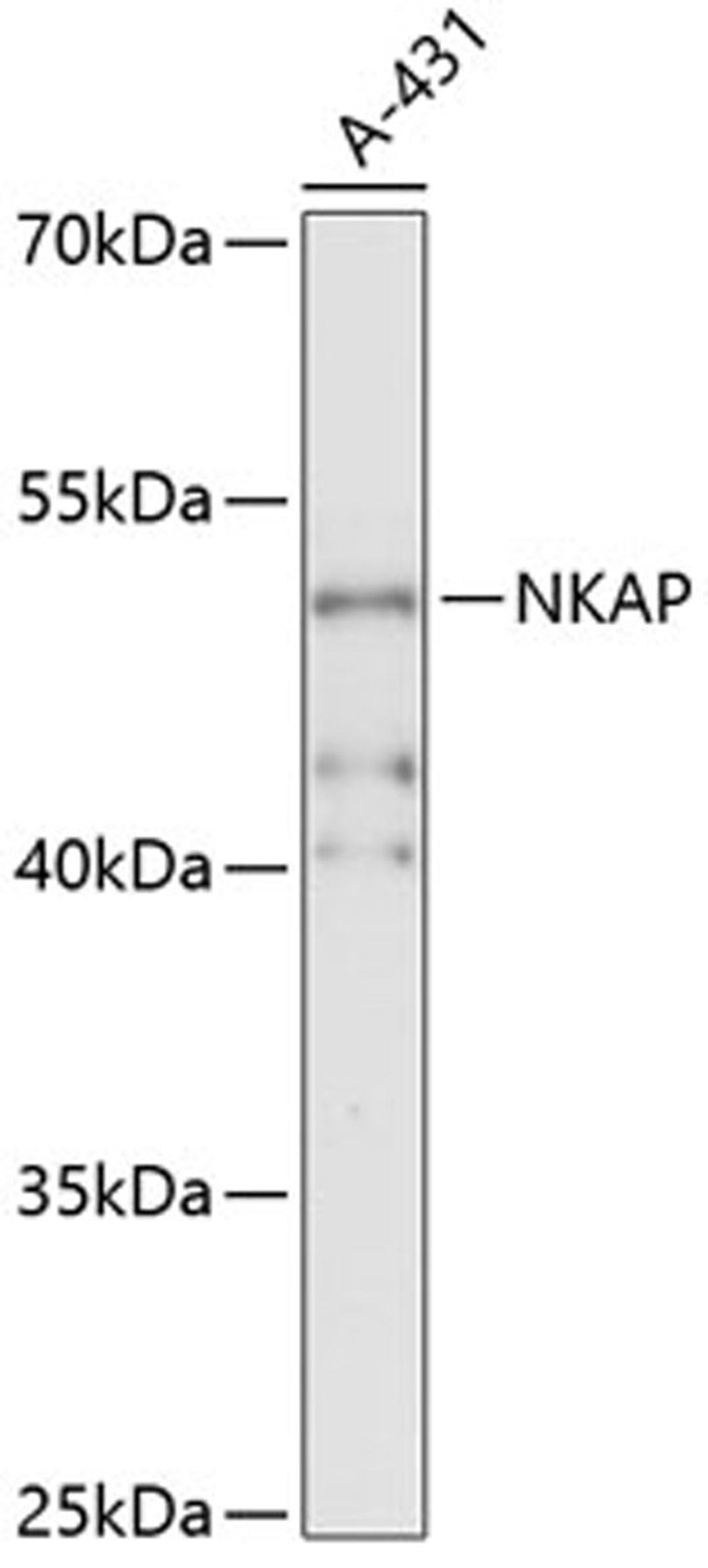 Western blot - NKAP antibody (A13748)