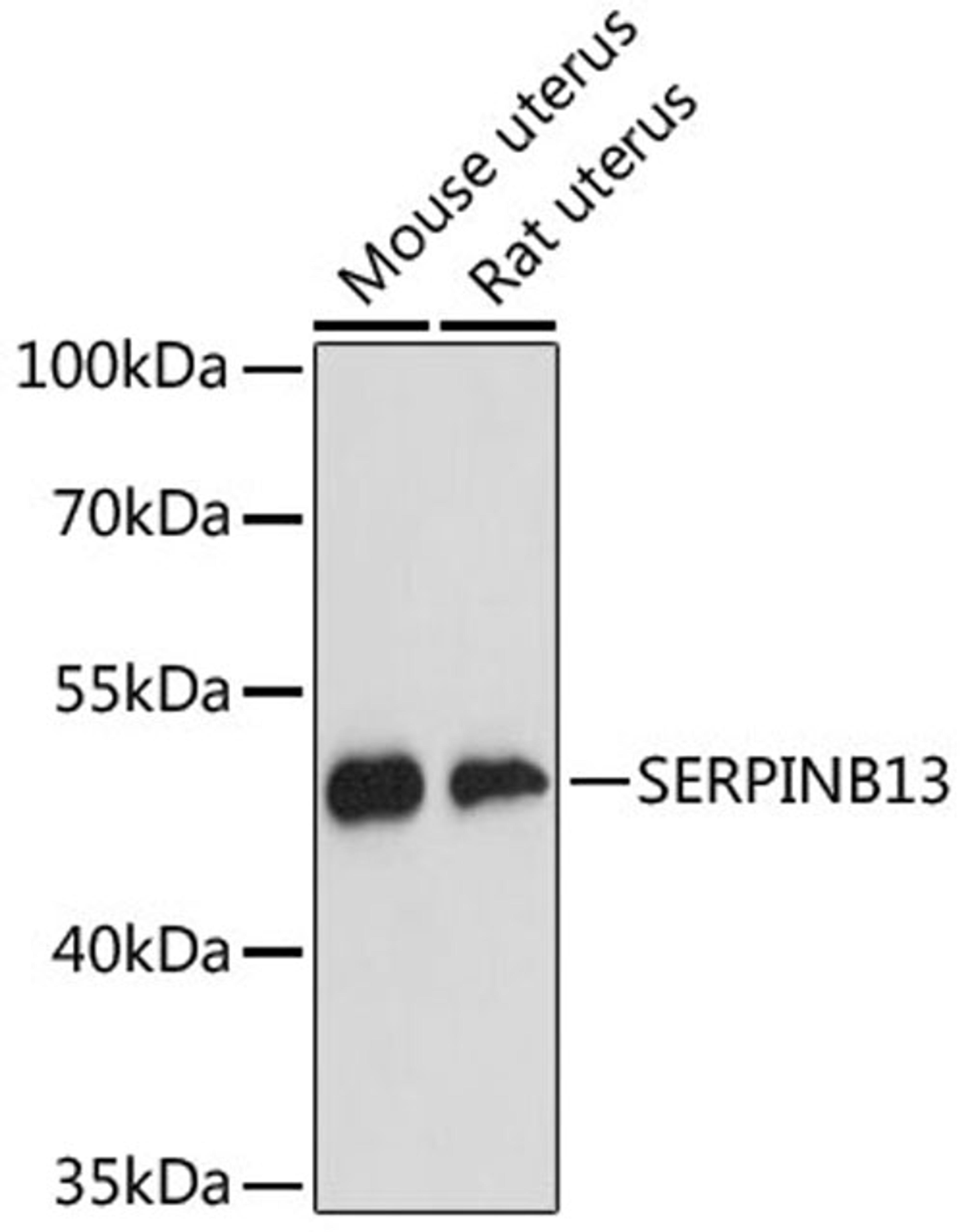 Western blot - SERPINB13 antibody (A13744)