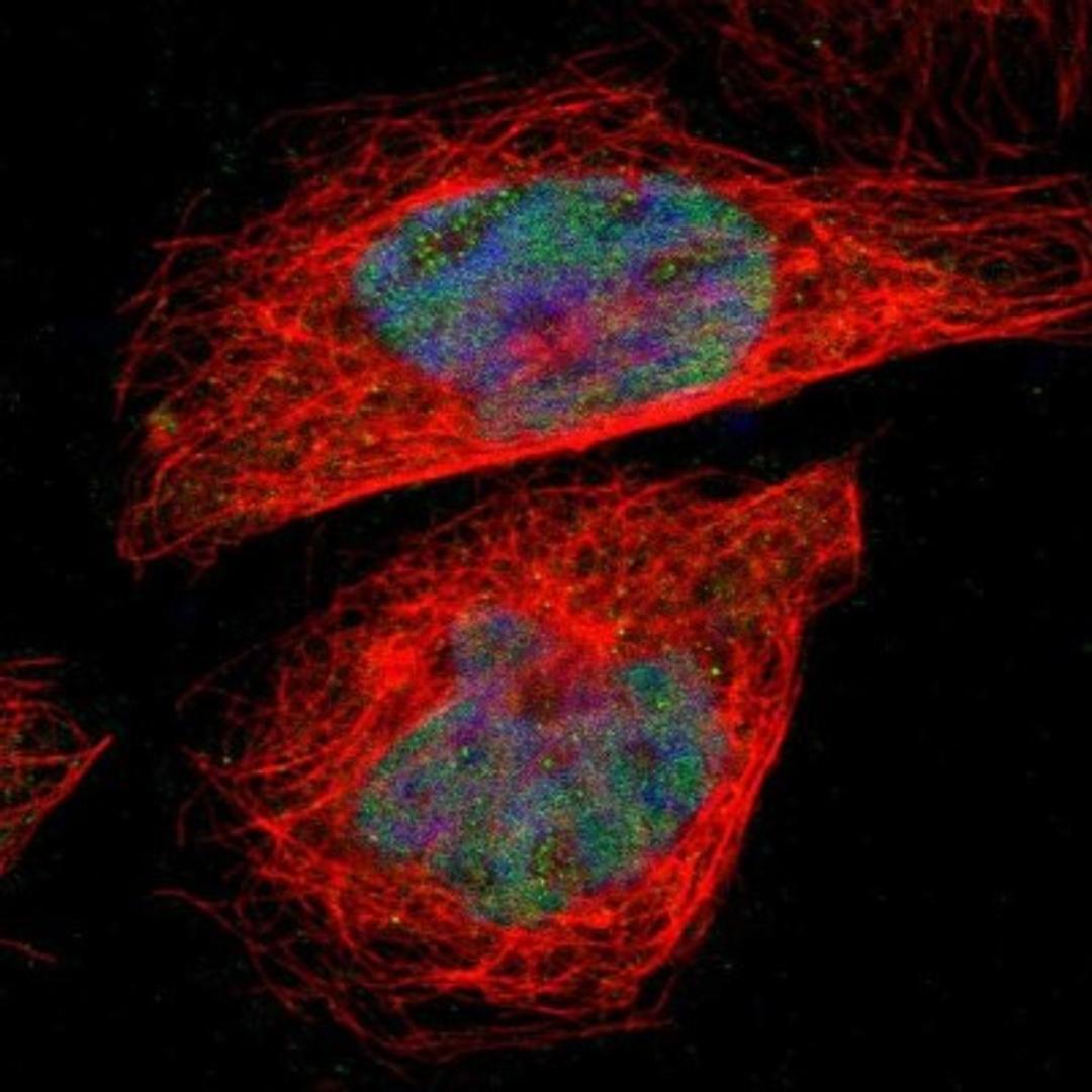 Immunocytochemistry/Immunofluorescence: HS747E2A Antibody [NBP1-89963] - Staining of human cell line A-431 shows positivity in nuclei.