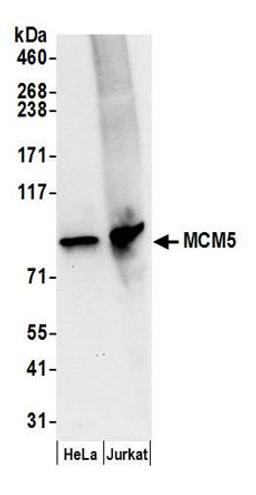 Detection of human MCM5 by western blot.