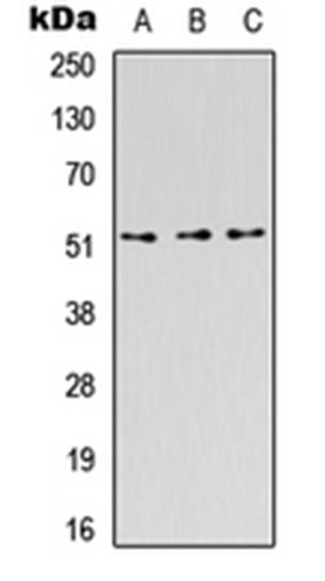 Western blot analysis of HEK293T (Lane1), Raw264.7 (Lane2), H9C2 (Lane3) whole cell using CD218b antibody