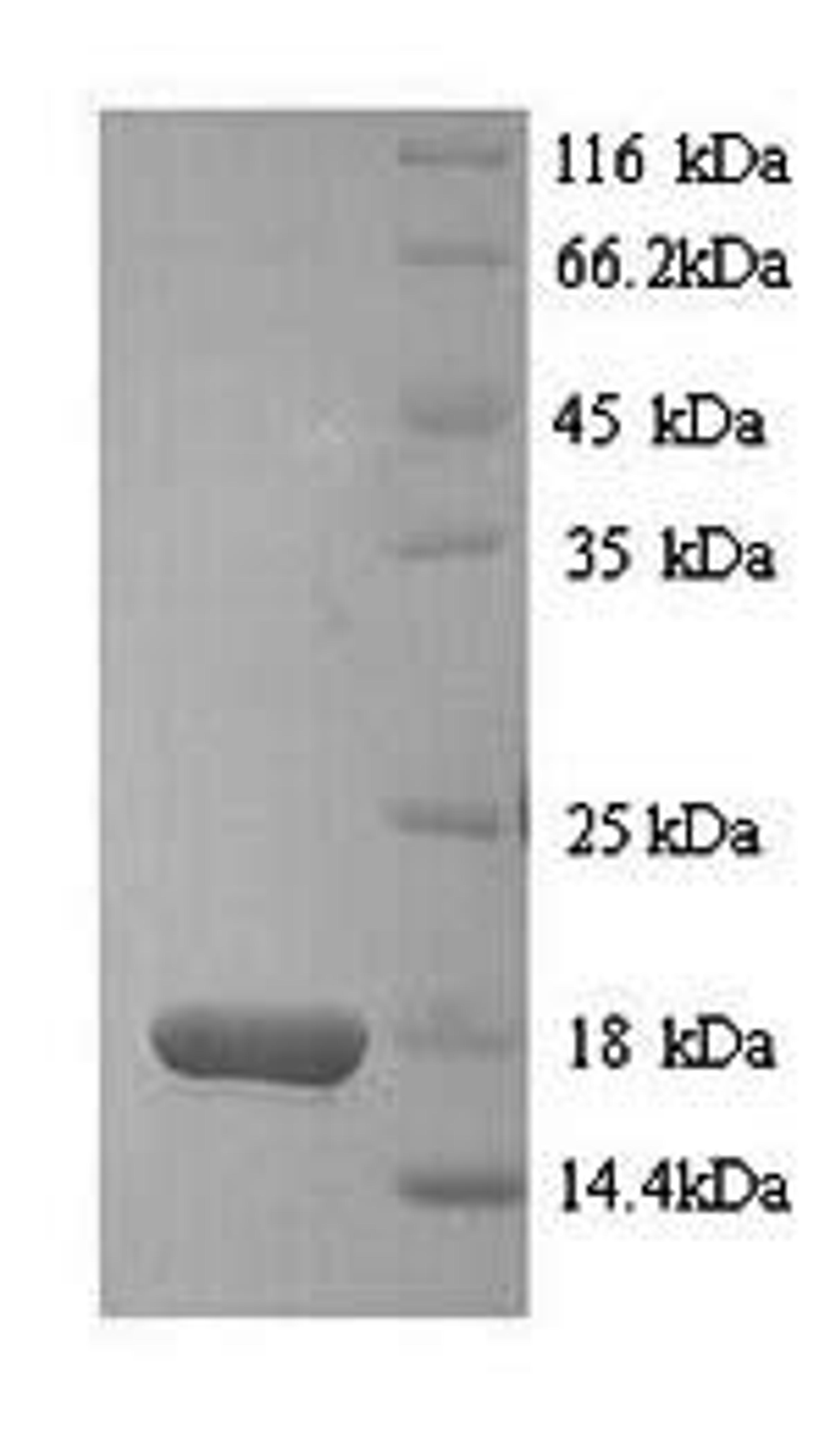 (Tris-Glycine gel) Discontinuous SDS-PAGE (reduced) with 5% enrichment gel and 15% separation gel.