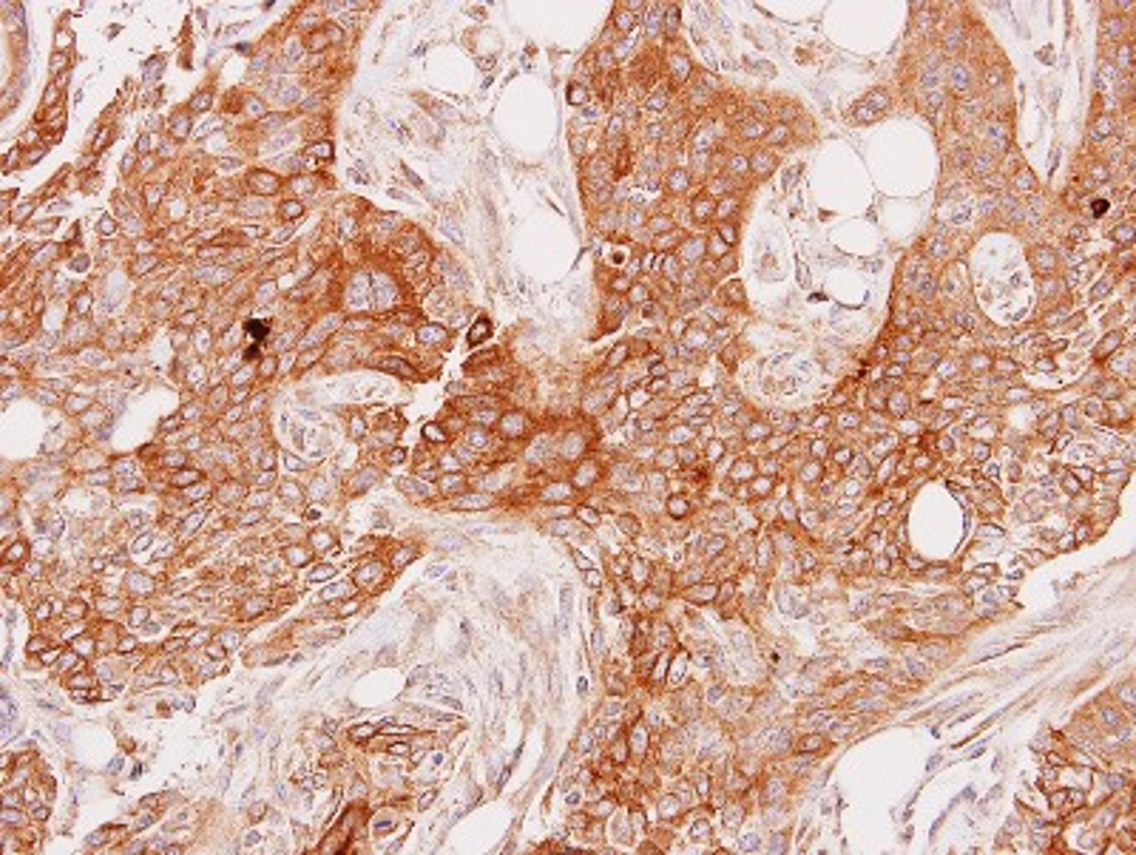 Immunohistochemistry-Paraffin: GSTA1 Antibody [NBP1-33586] - Paraffin-embedded PC3 xenograft, using antibody at 1:100 dilution.