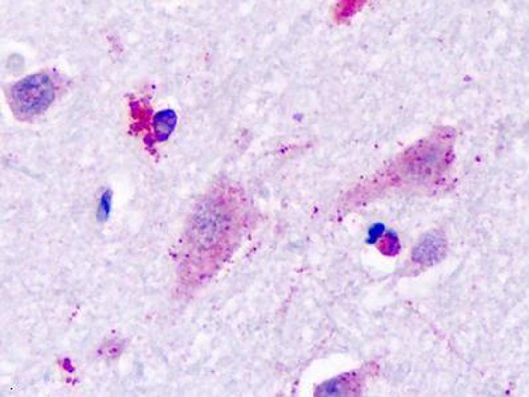 Immunohistochemistry-Paraffin: Histamine H3 R Antibody [NLS3262] - Analysis of anti-Histamine 3 Receptor / HRH3 antibody with human brain, neurons.